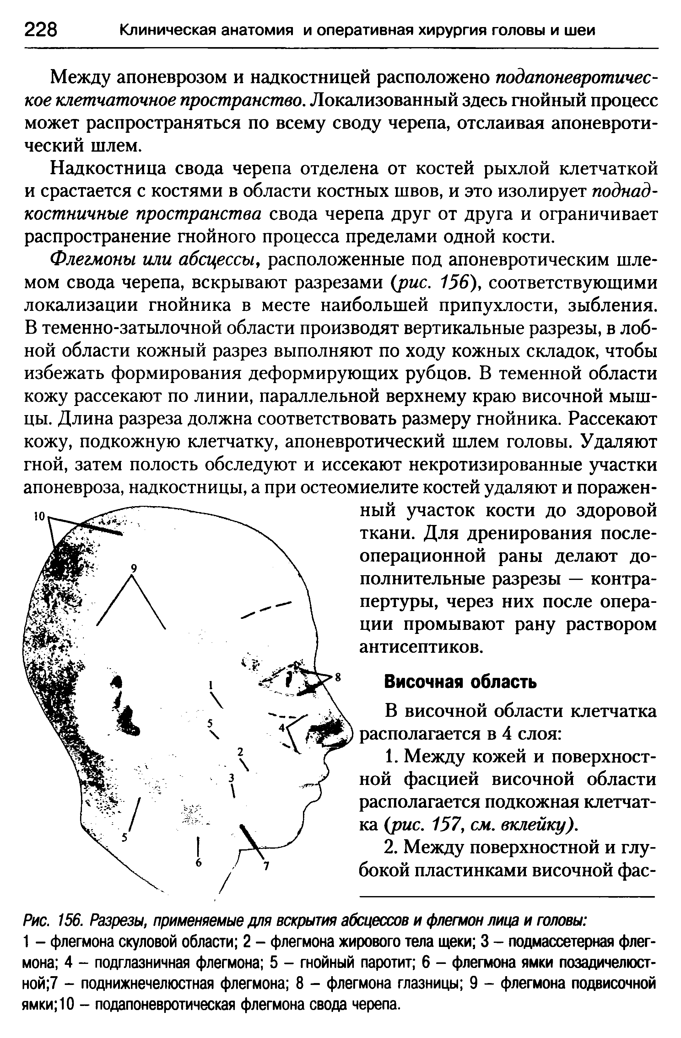 Рис. 156. Разрезы, применяемые для вскрытия абсцессов и флегмон лица и головы ...