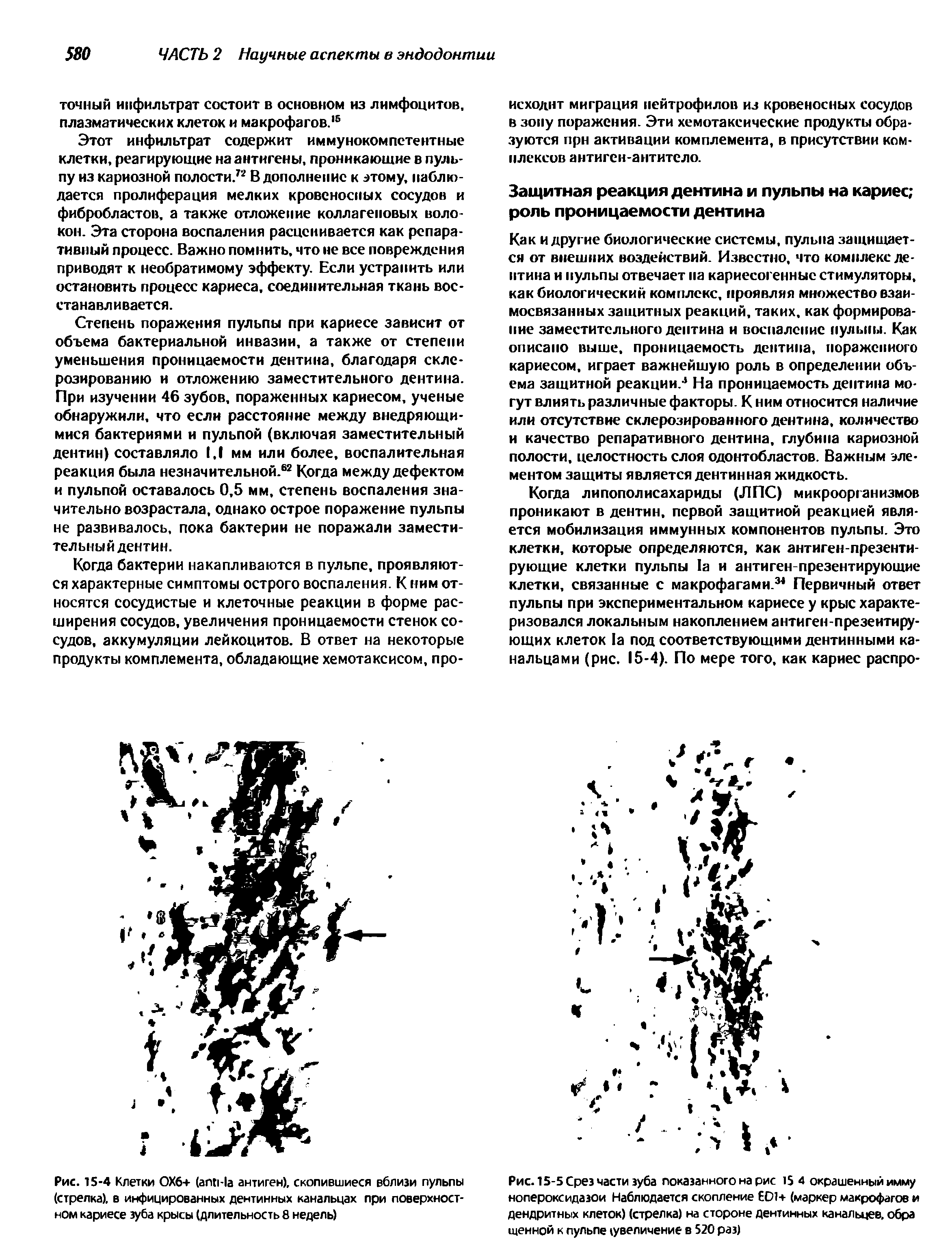 Рис. 15-4 Клетки 0X6+ (апп-1а антиген), скопившиеся вблизи пульпы (стрелка), в инфицированных дентинных канальцах при поверхностном кариесе зуба крысы (длительность 8 недель)...