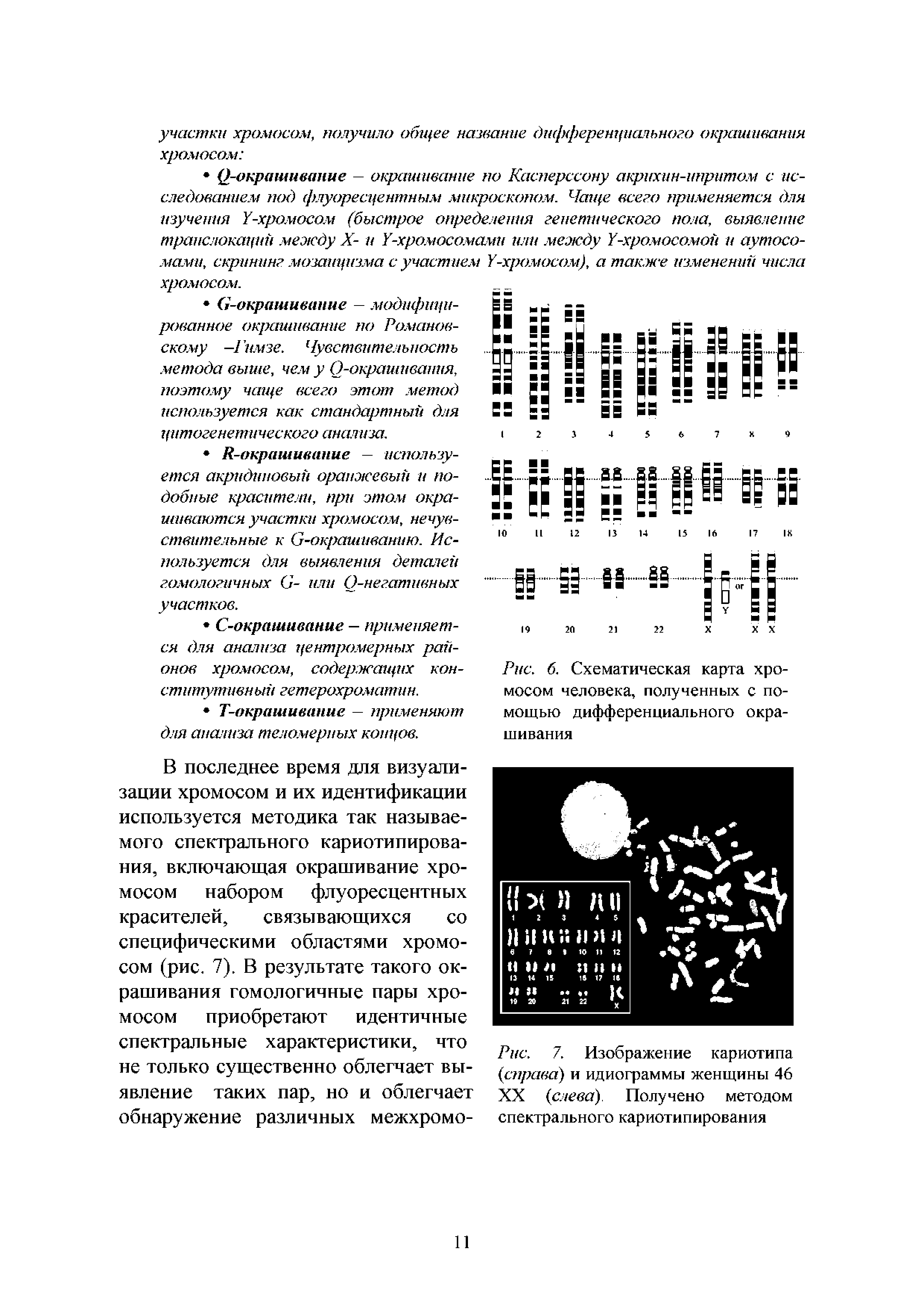 Рис. 7. Изображение кариотипа (справа) и идиограммы женщины 46 XX (слева). Получено методом спектрального кариотипирования...