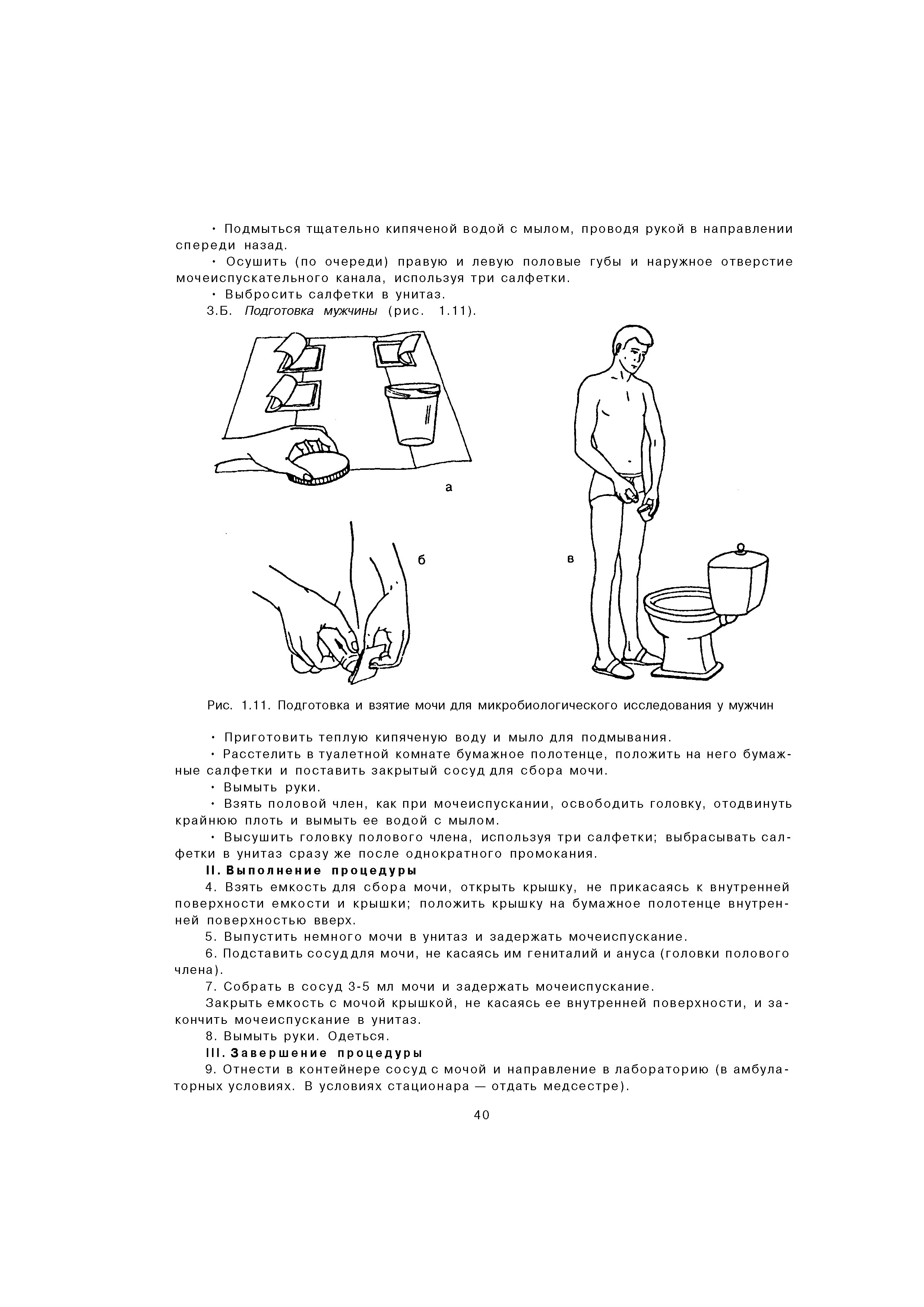 Рис. 1.11. Подготовка и взятие мочи для микробиологического исследования у мужчин...