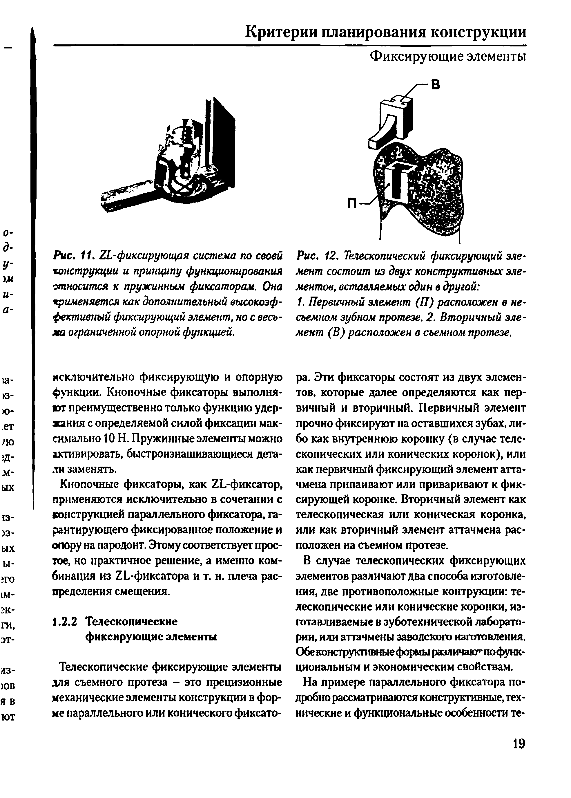 Рис. 12. Телескопический фиксирующий элемент состоит из двух конструктивных элементов, вставляемых один в другой ...