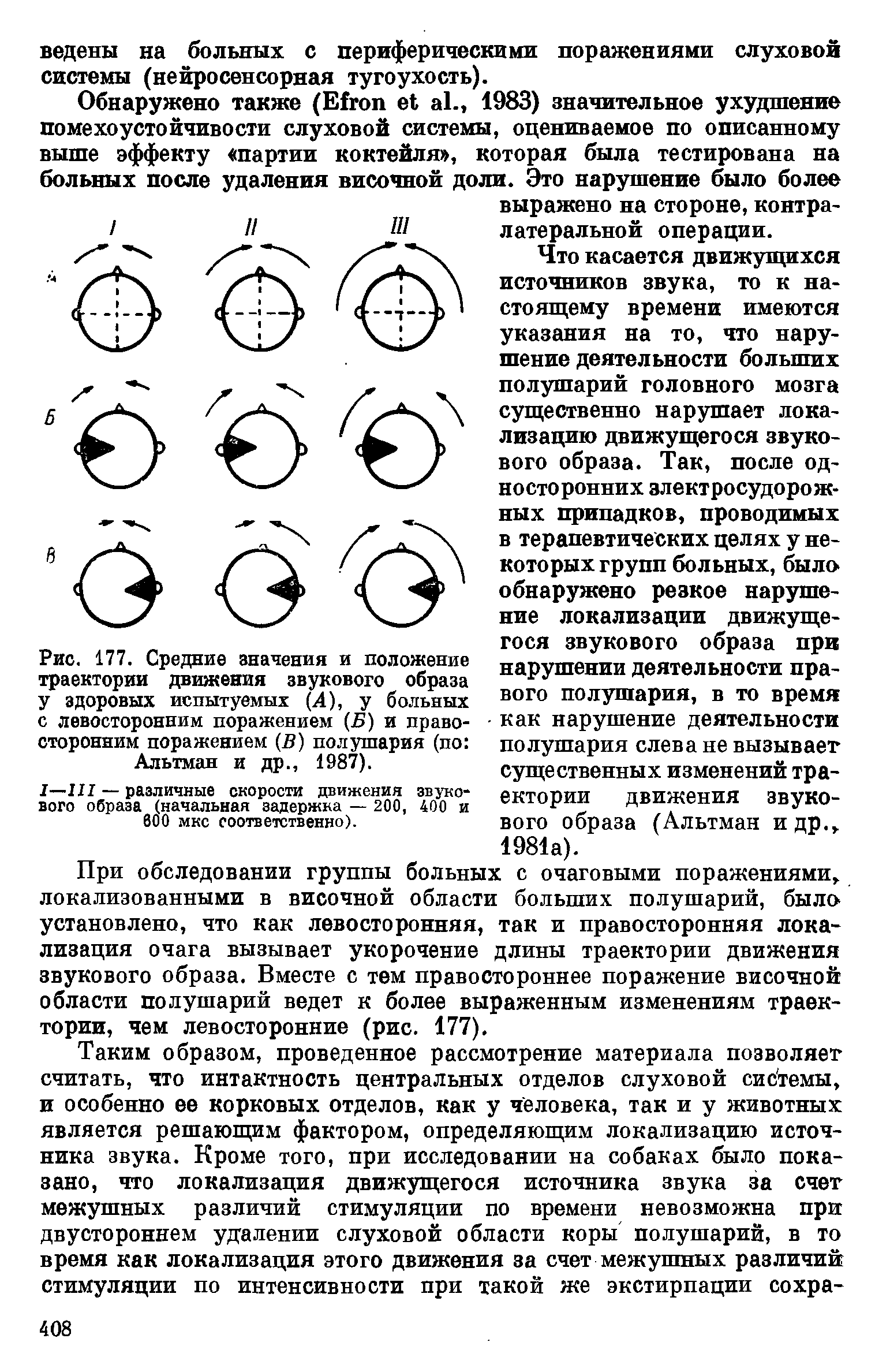 Рис. 177. Средние значения и положение траектории движения звукового образа у здоровых испытуемых (4), у больных с левосторонним поражением (Б) и правосторонним поражением (В) полушария (по Альтман и др., 1987).