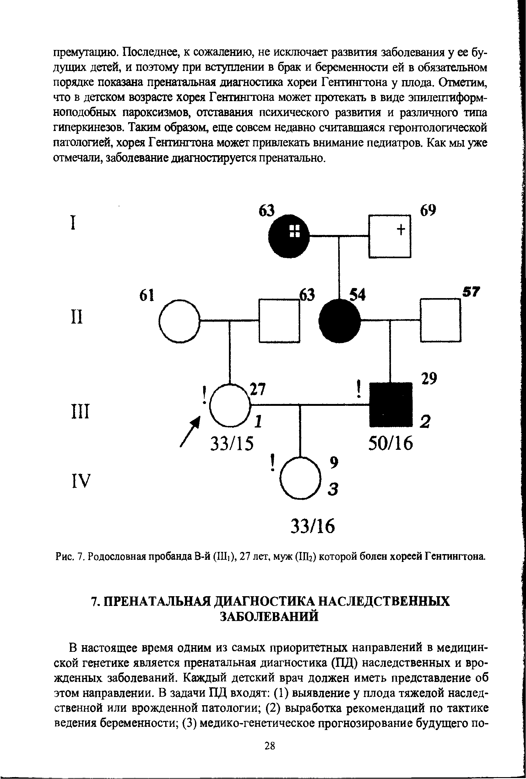 Рис. 7. Родословная пробанда В-й (III,), 27 лет, муж (Ша) которой болен хореей Гентингтона.