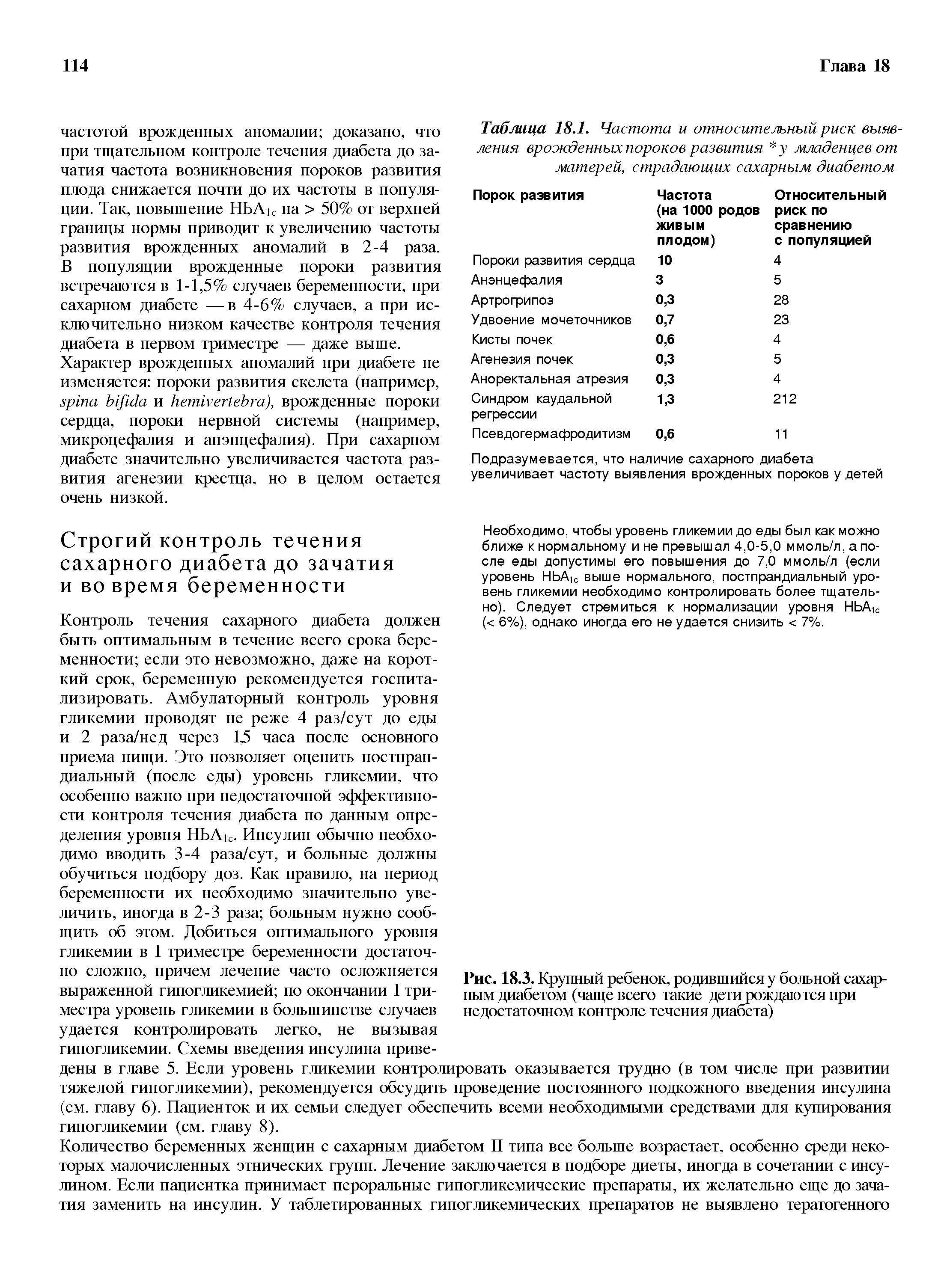 Рис. 18.3. Крупный ребенок, родившийся у больной сахарным диабетом (чаще всего такие дети рождаются при недостаточном контроле течения диабета)...