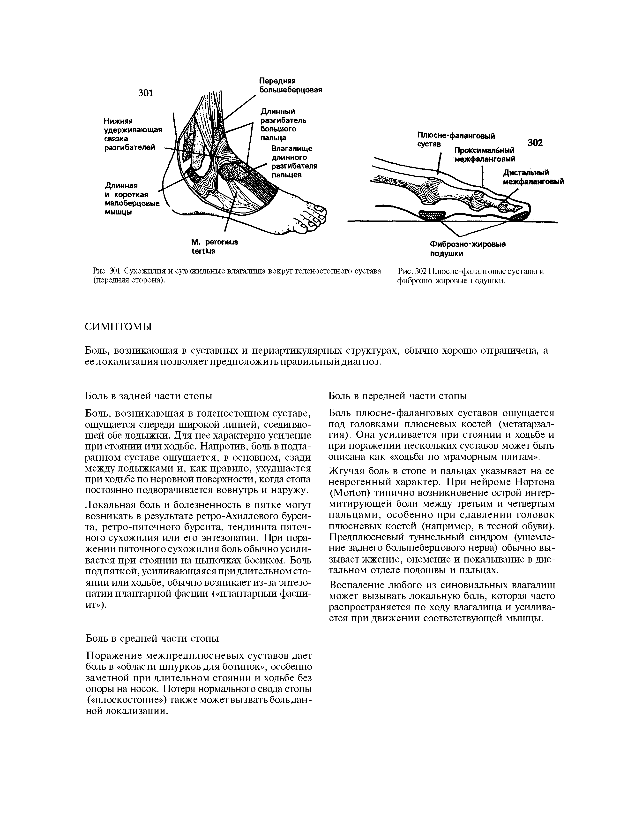 Рис. 302 Плюсне-фаланговые суставы и фиброзно-жировые подушки.