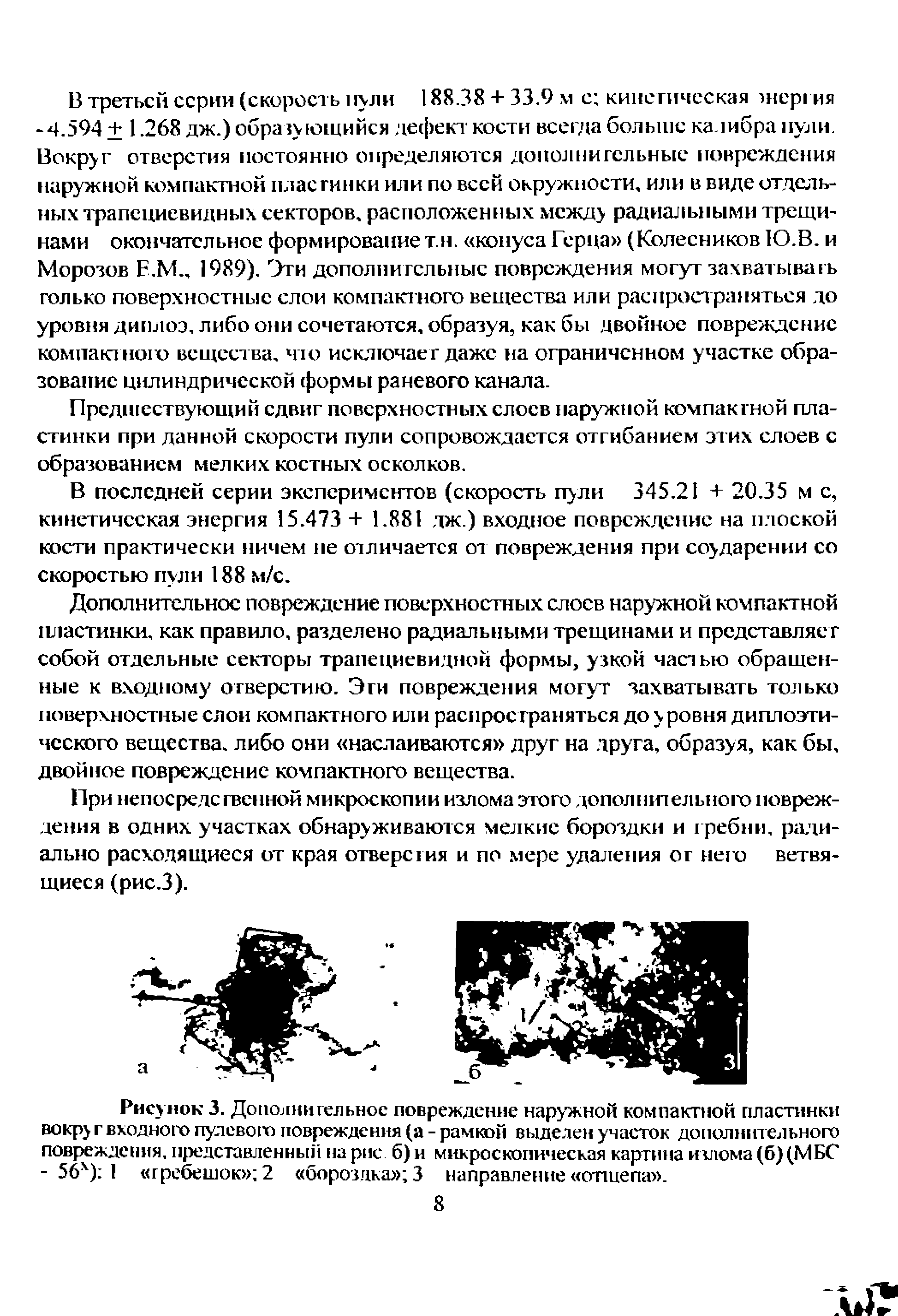 Рисунок 3. Дополнительное повреждение наружной компактной пластинки вокруг входного пулевого повреждения (а - рамкой выделен участок дополнительного повреждения, представленный на рис б) и микроскопическая картина излома (б)(МБС - 56х) I гребешок 2 бороздка 3 направление отитепа .