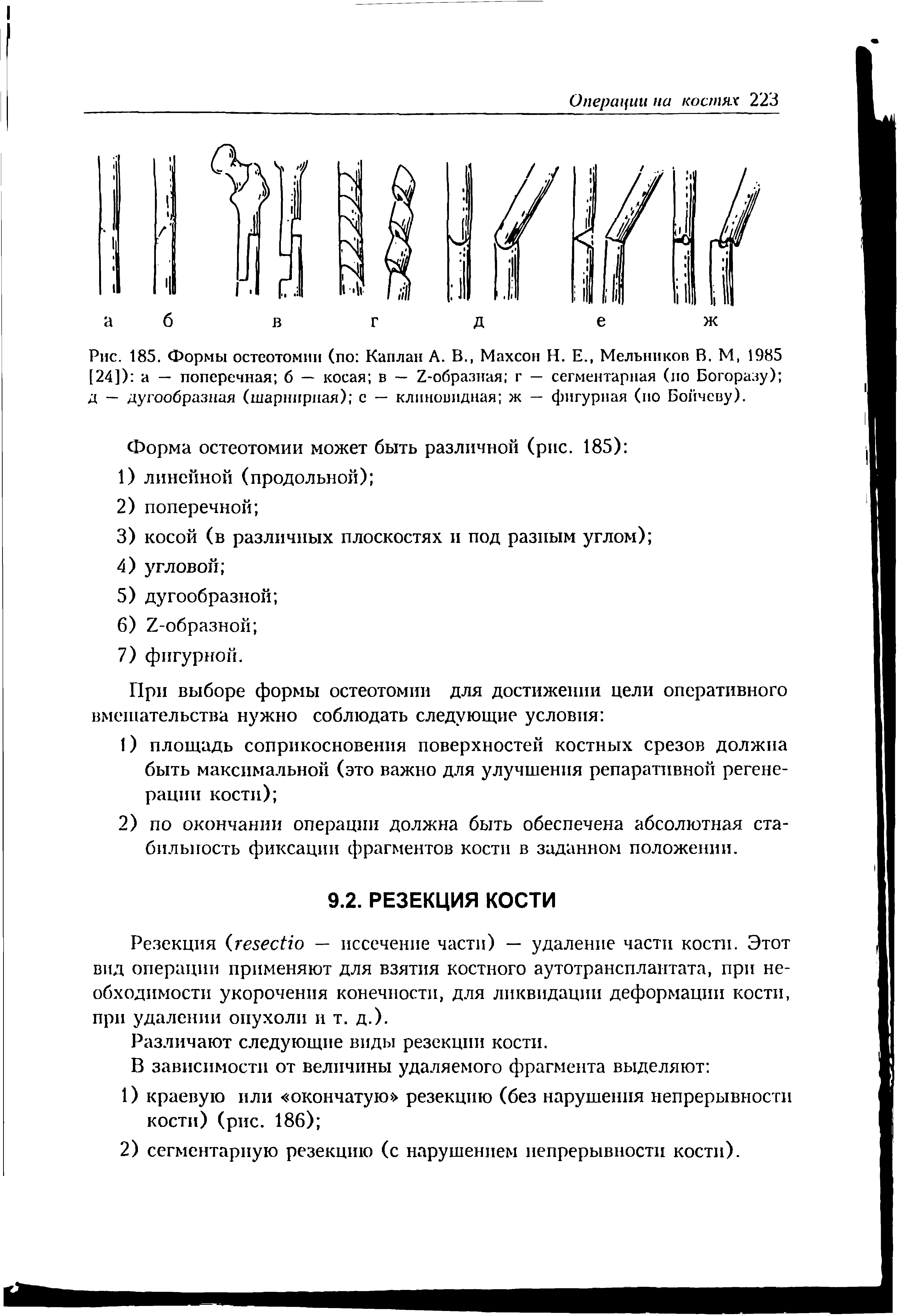 Рис. 185. Формы остеотомии (по Каплан А. В., Махсон Н. Е., Мельников В. М, 1985 [24]) а — поперечная 6 — косая в — г-образиая г — сегментарная (по Богоразу) д — дугообразная (шарнирная) с — клиновидная ж — фигурная (ио Боичеву).