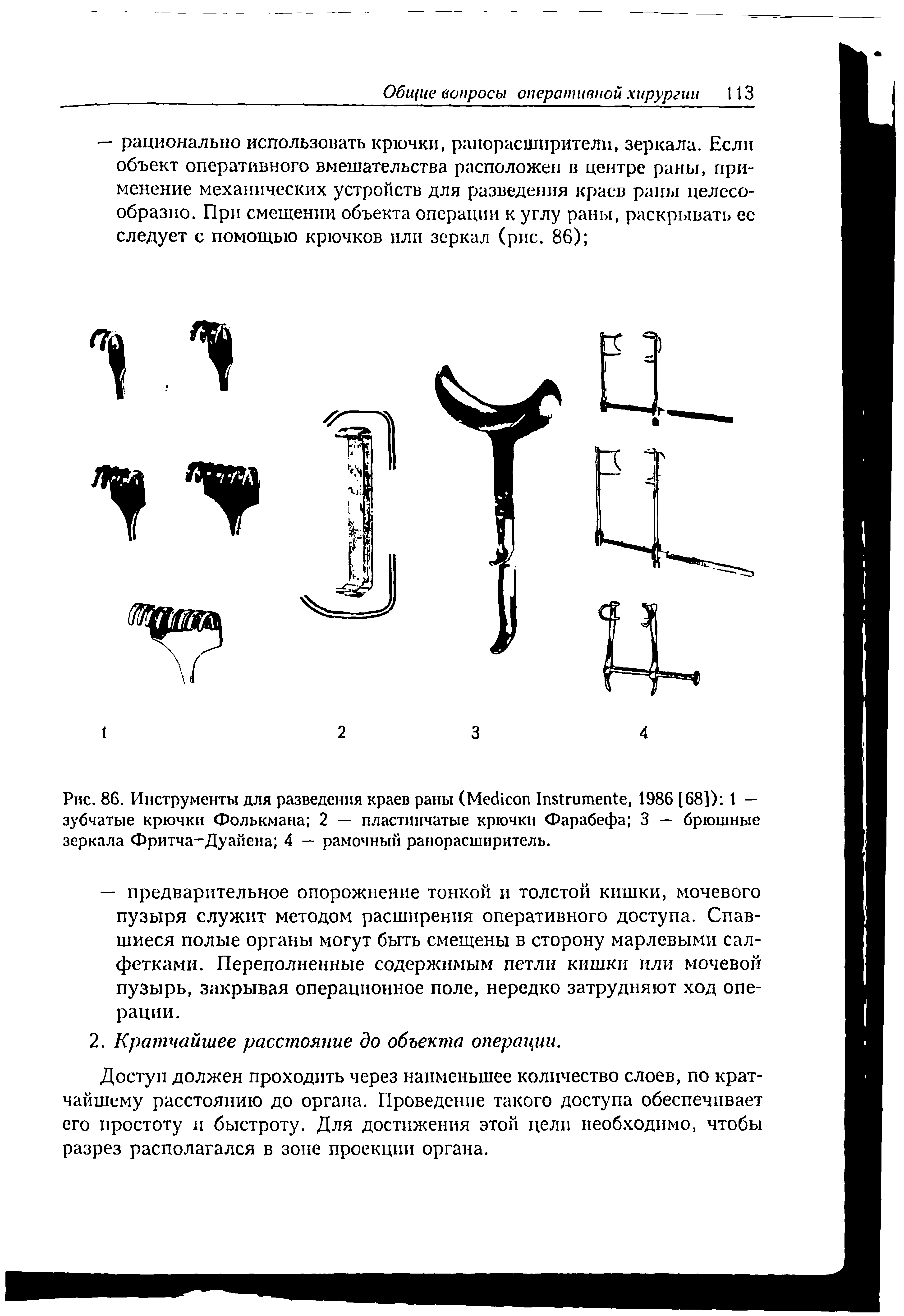 Рис. 86. Инструменты для разведения краев раны (M I , 1986 [68]) 1 — зубчатые крючки Фолькмана 2 — пластинчатые крючки Фарабефа 3 — брюшные зеркала Фритча-Дуайена 4 — рамочный ранорасширитель.