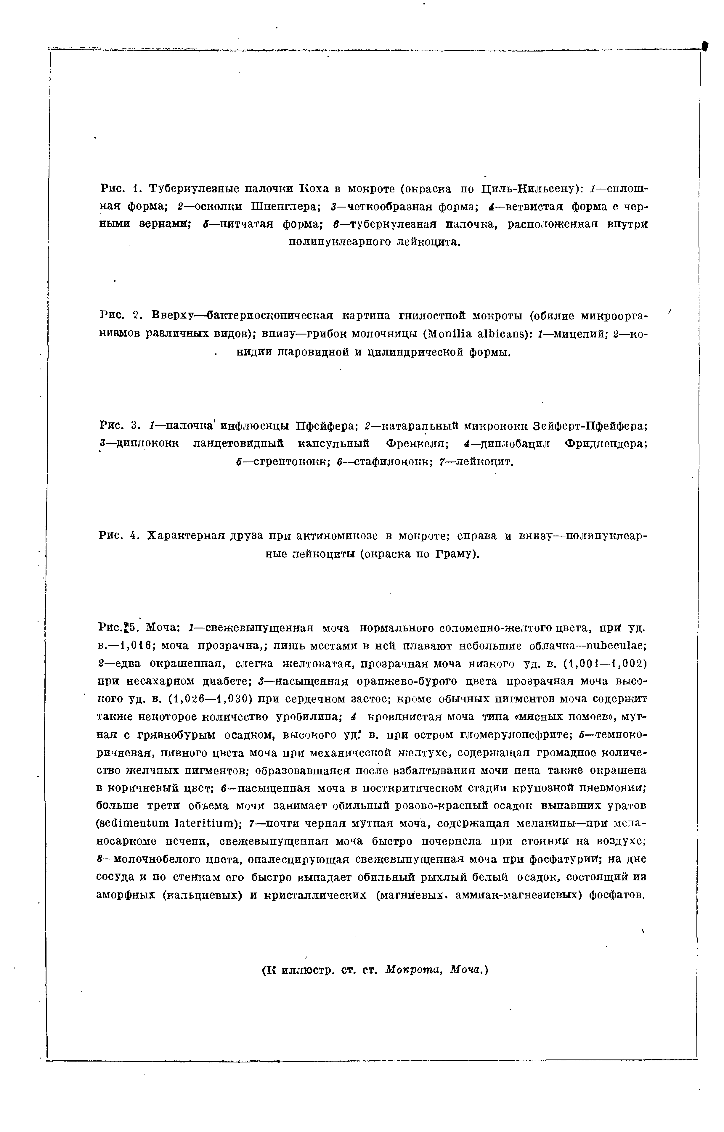 Рис. 2. Вверху—бактериоскопическая картина гнилостной мокроты (обилие микроорганизмов различных видов) внизу—грибок молочницы (M ) I—мицелий 2—конидии шаровидной и цилиндрической формы.