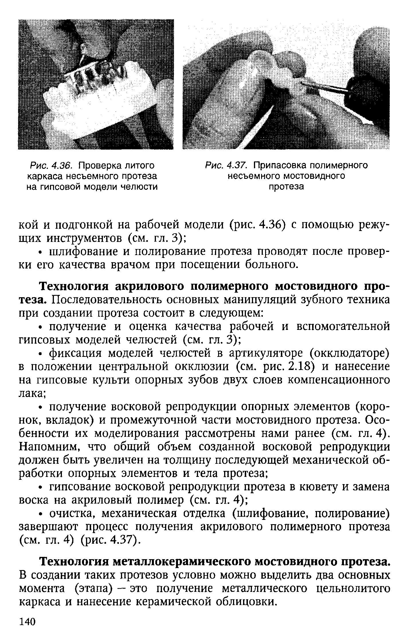 Рис. 4.36. Проверка литого каркаса несъемного протеза на гипсовой модели челюсти...