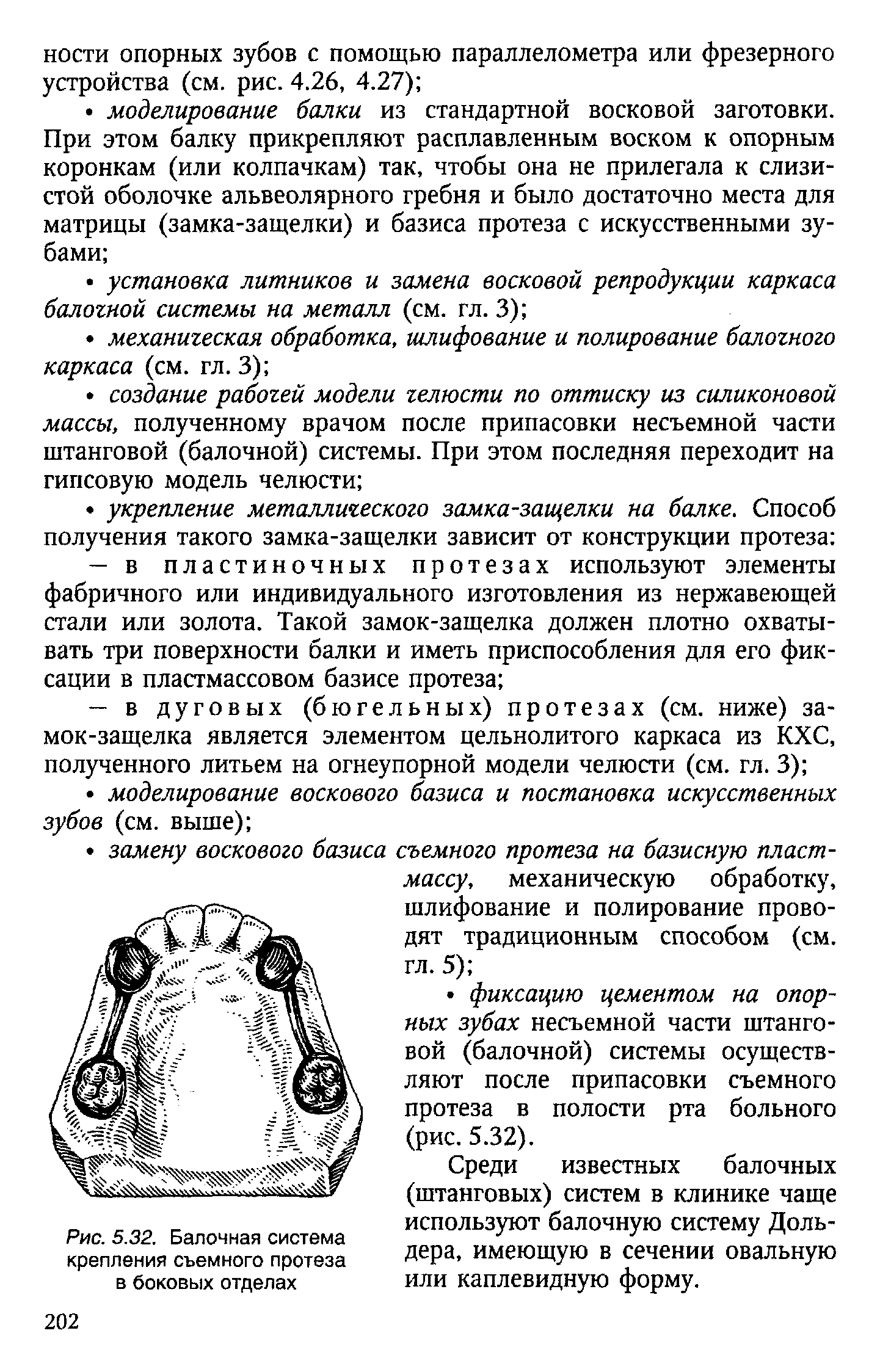 Рис. 5.32. Балочная система крепления съемного протеза в боковых отделах...