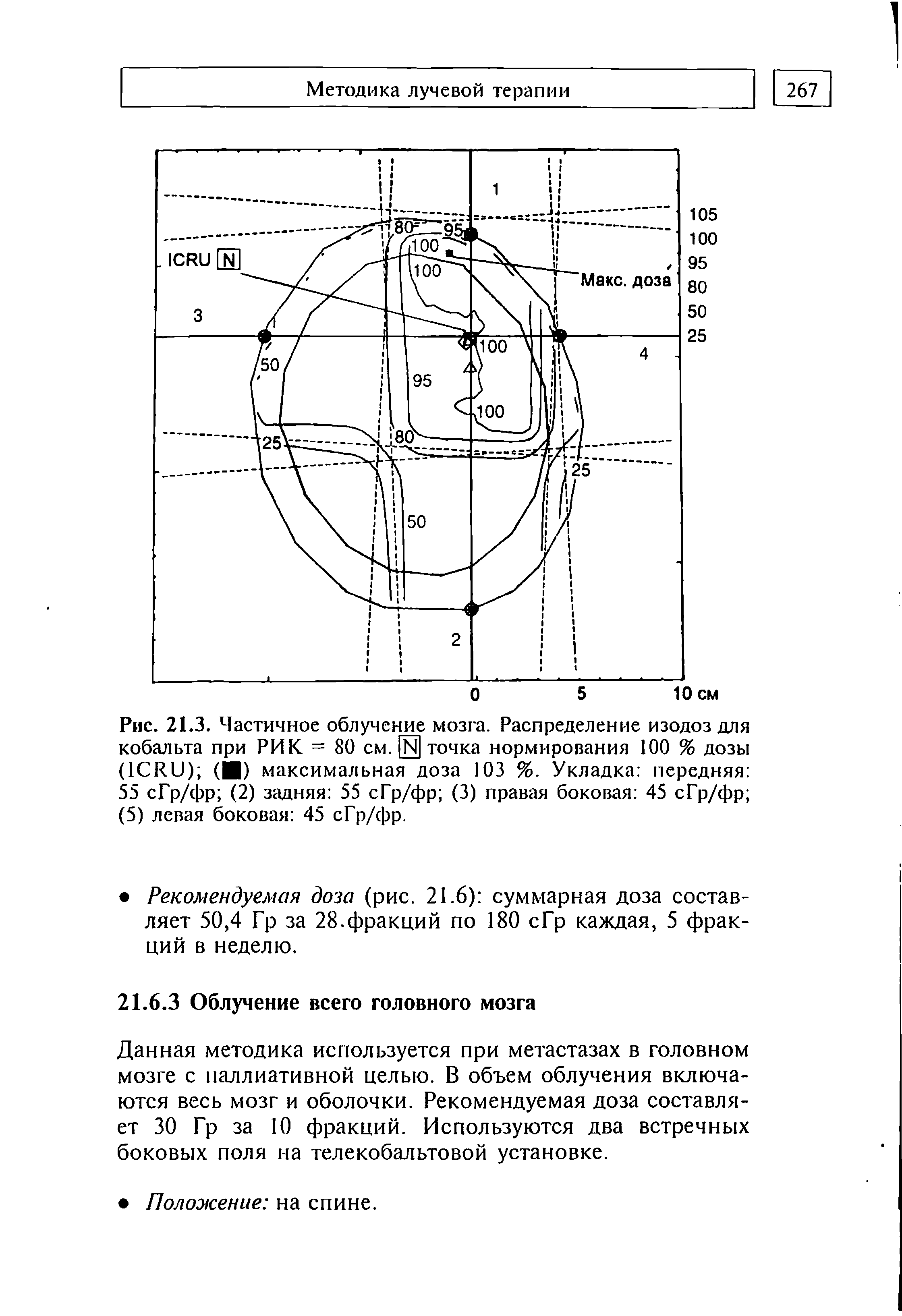 Рис. 21.3. Частичное облучение мозга. Распределение изодоз для кобальта при РИК = 80 см. [Й] точка нормирования 100 % дозы (1СИи) ( ) максимальная доза 103 %. Укладка передняя 55 сГр/фр (2) задняя 55 сГр/фр (3) правая боковая 45 сГр/фр (5) левая боковая 45 сГр/фр.