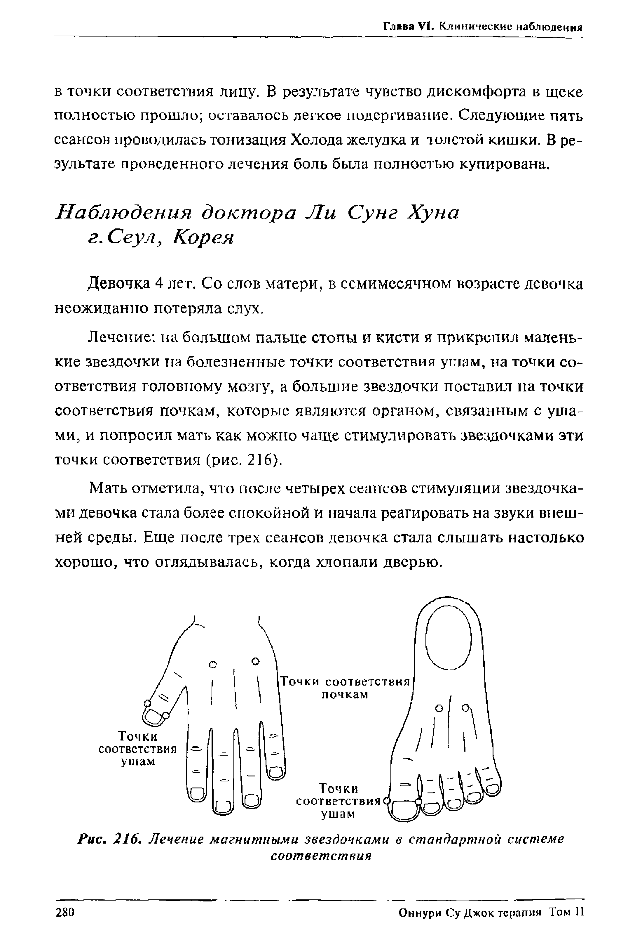 Рис. 216. Лечение магнитными звездочками в стандартной системе соответствия...