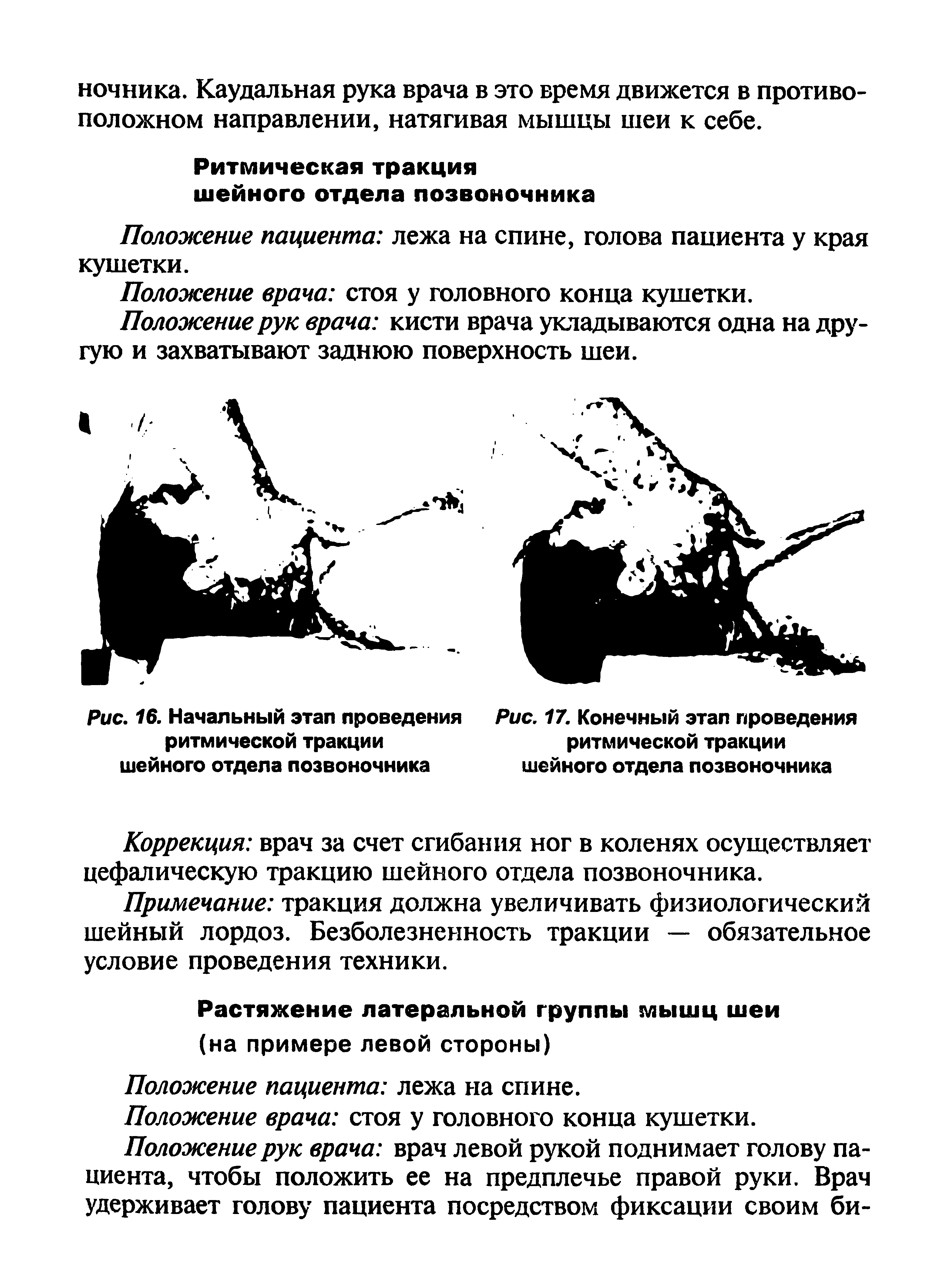 Рис. 16. Начальный этап проведения ритмической тракции шейного отдела позвоночника...