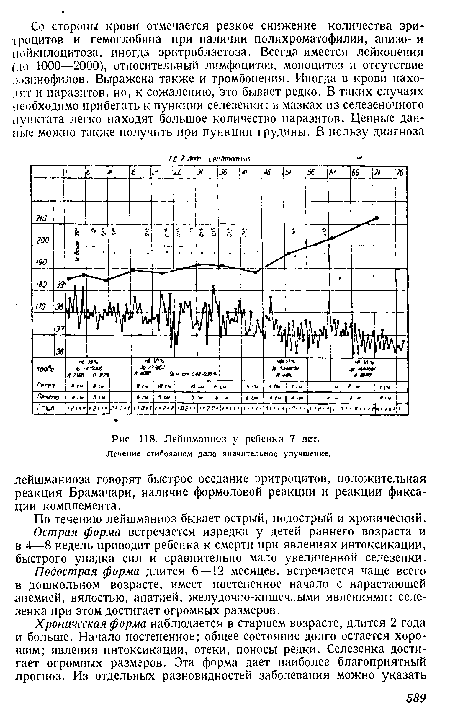 Рис. 118. Лейшманиоз у ребенка 7 лет. Лечение стибозаном дало значительное улучшение.