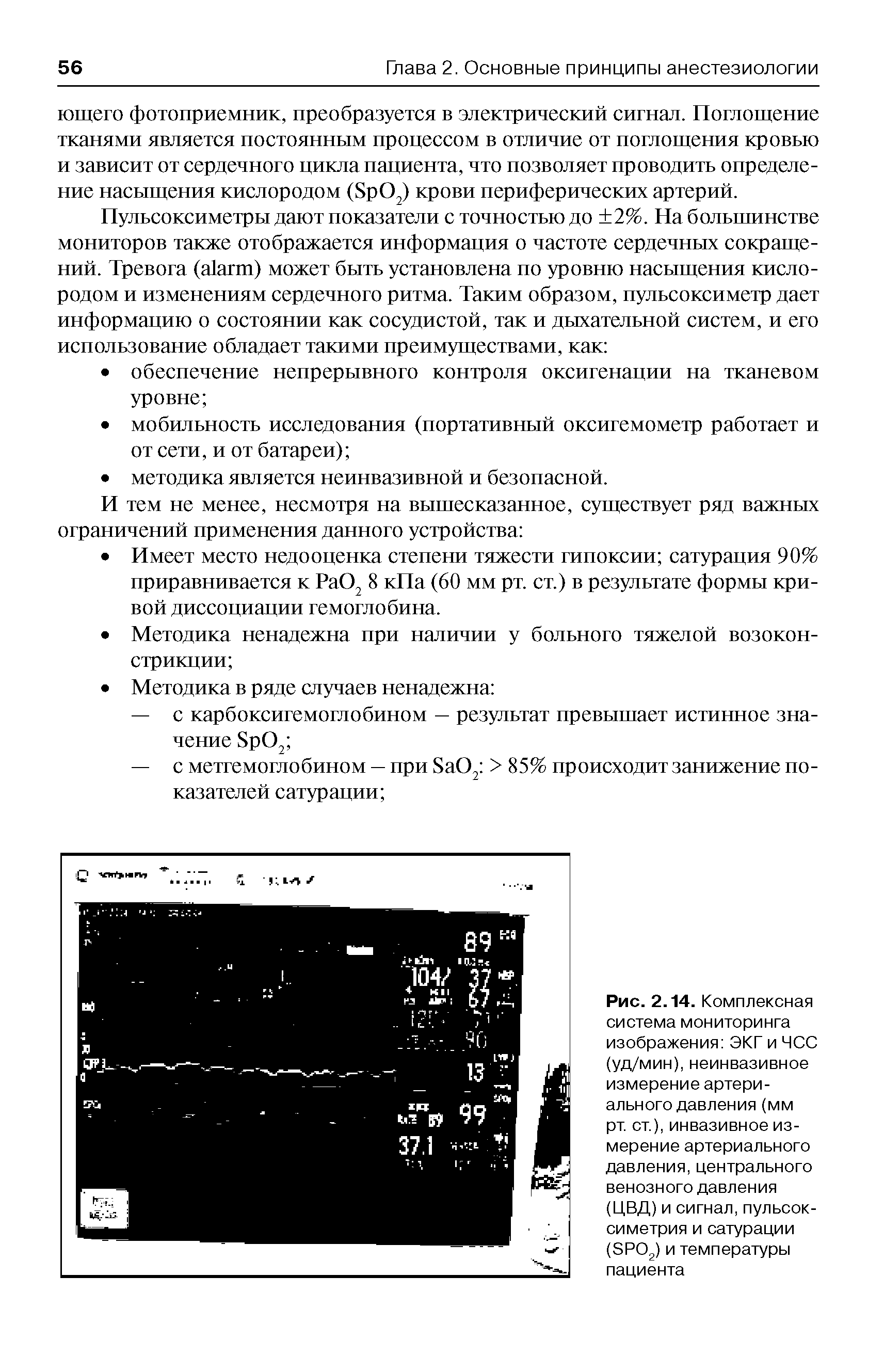 Рис. 2.14. Комплексная система мониторинга изображения ЭКГ и ЧСС (уд/мин), неинвазивное измерение артериального давления (мм рт. ст.), инвазивное измерение артериального давления, центрального венозного давления (ЦВД) и сигнал, пульсок-симетрия и сатурации (ЭРО2) и температуры пациента...