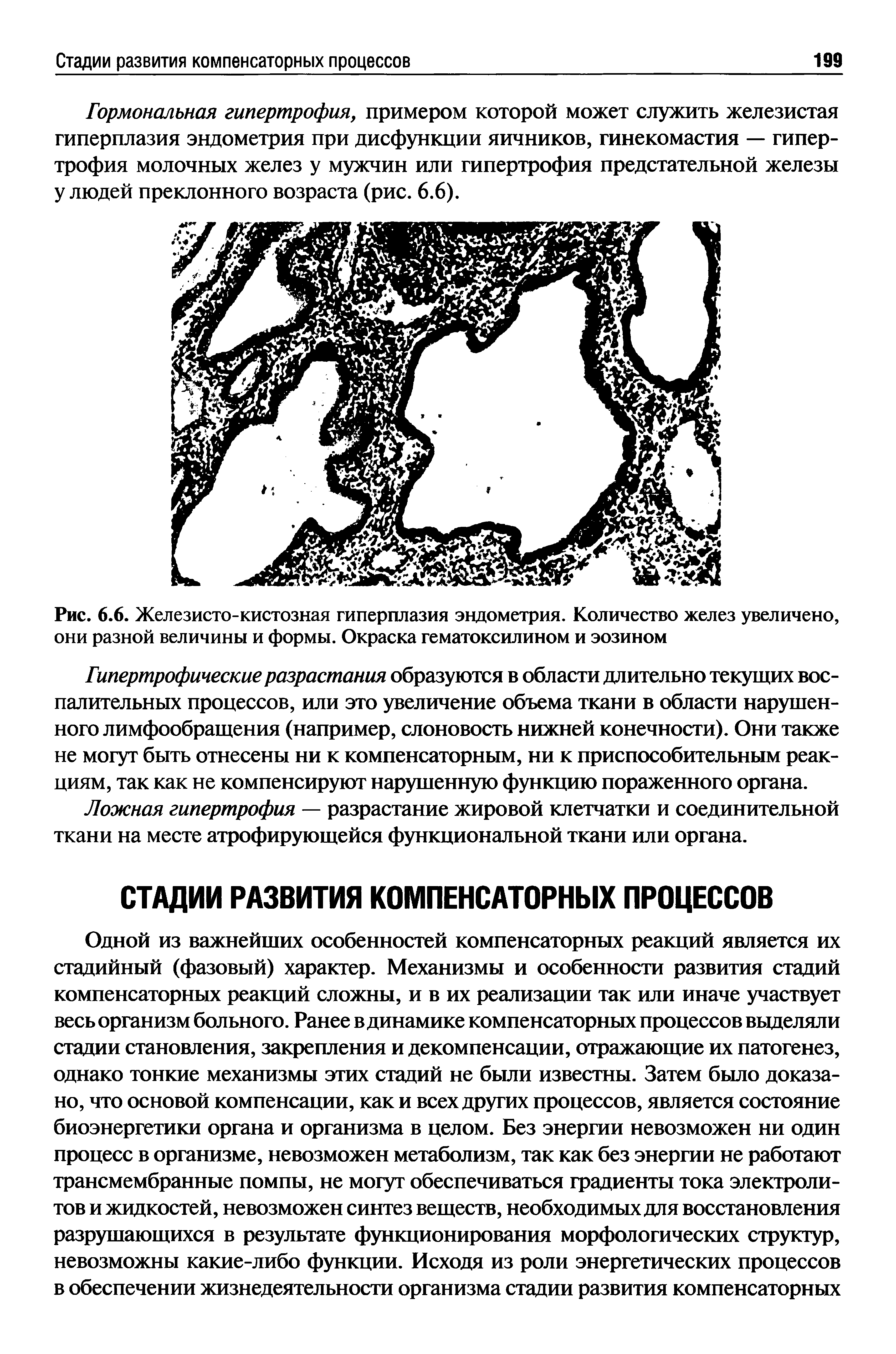 Рис. 6.6. Железисто-кистозная гиперплазия эндометрия. Количество желез увеличено, они разной величины и формы. Окраска гематоксилином и эозином...