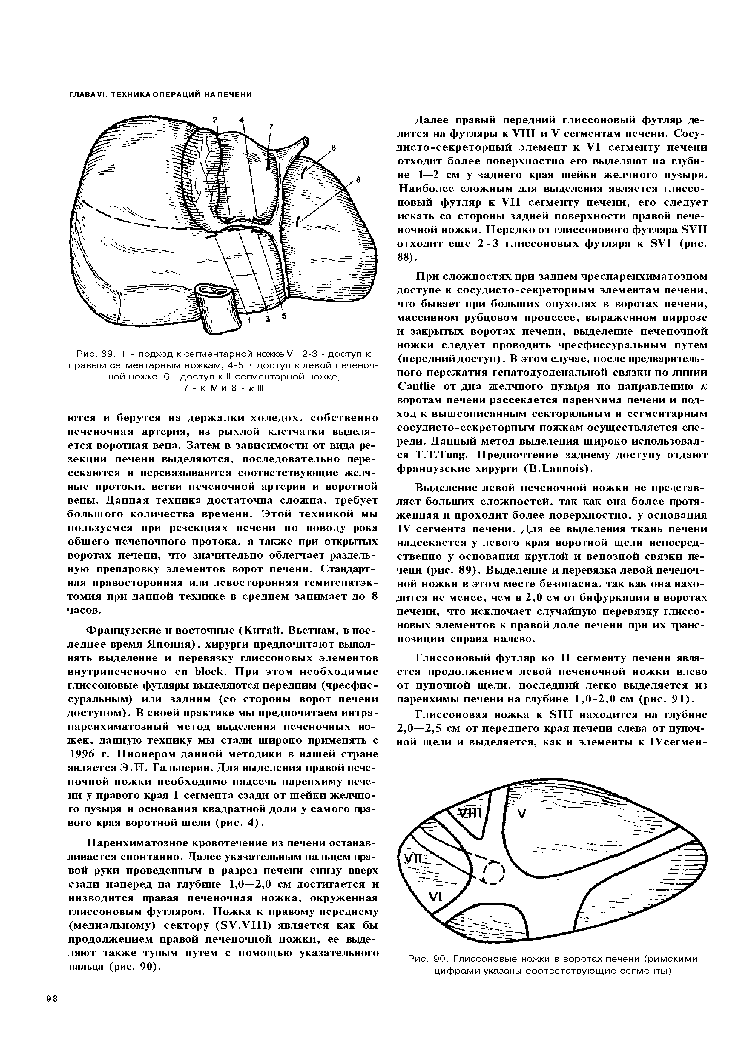 Рис. 90. Глиссоновые ножки в воротах печени (римскими цифрами указаны соответствующие сегменты)...