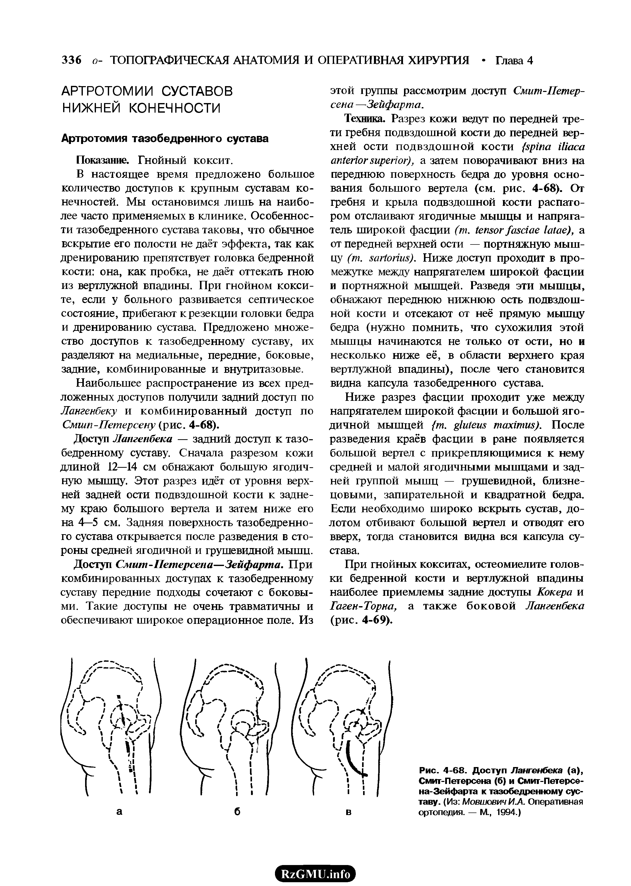 Рис. 4-68. Доступ Лангенбека (а), Смит-Петерсена (б) и Смит-Петерсе-на-Зейфарта к тазобедренному суставу. (Из Мовшович И.А. Оперативная ортопедия. — М., 1994.)...