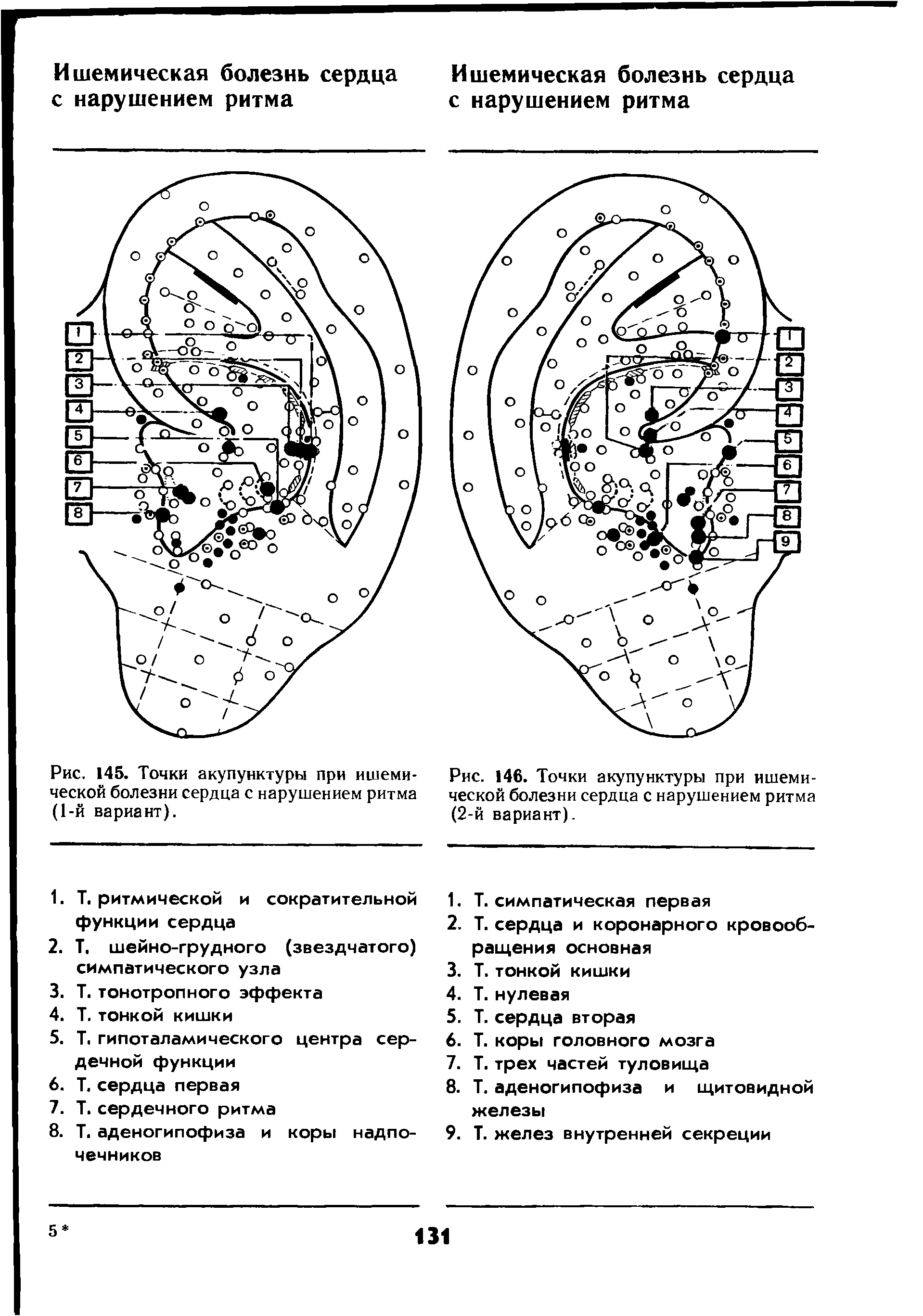 Рис. 145. Точки акупунктуры при ишемической болезни сердца с нарушением ритма (1-й вариант).