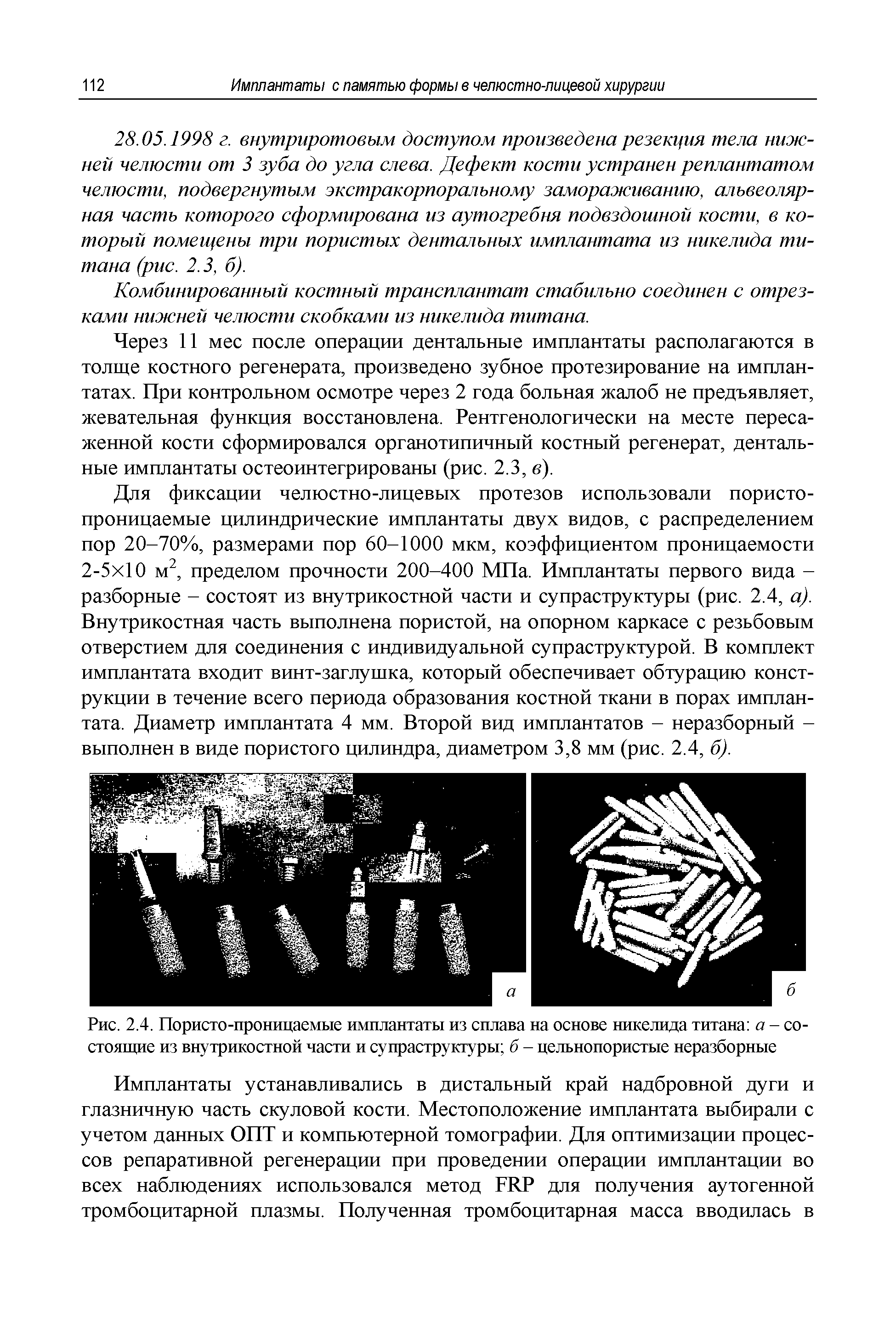 Рис. 2.4. Пористо-проницаемые имплантаты из сплава на основе никелида титана а - состоящие из внутрикостной части и супраструктуры б - цельнопористые неразборные...