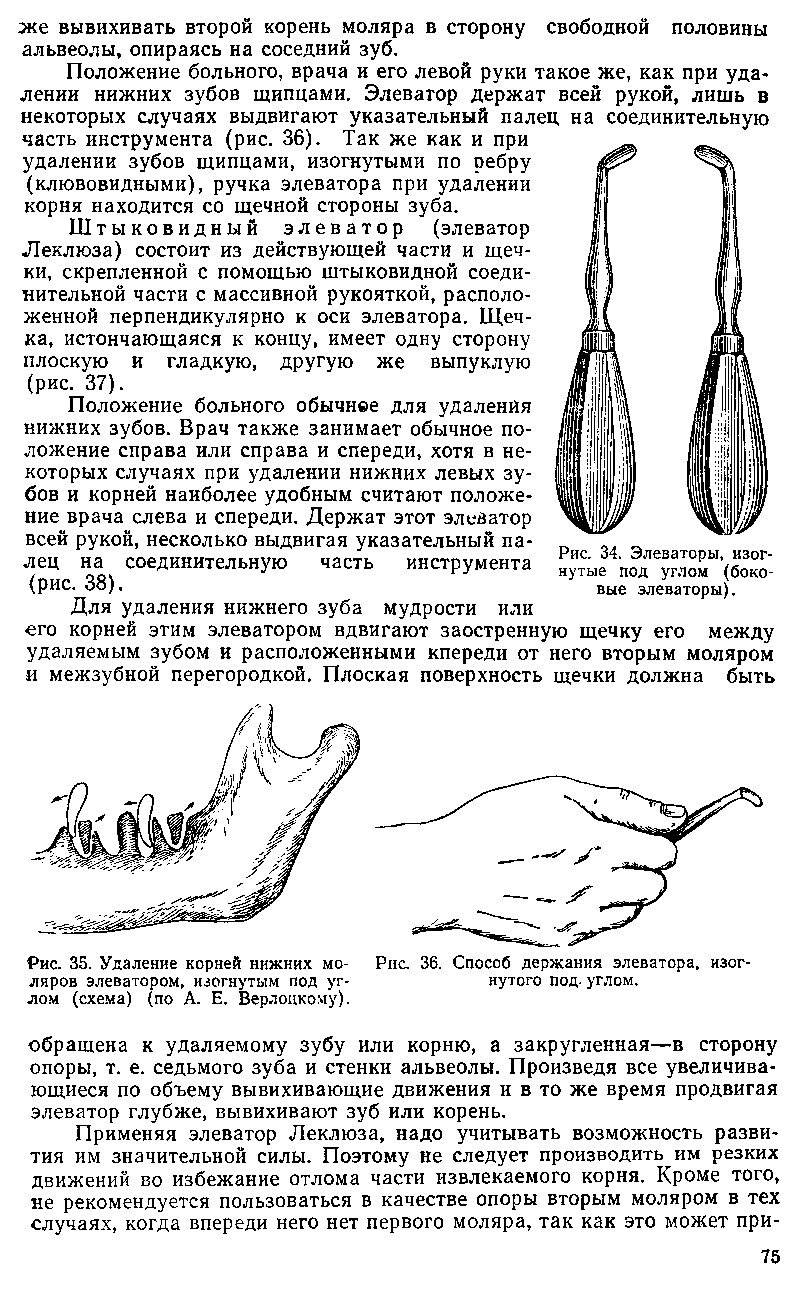 Рис. 35. Удаление корней нижних мо- Рис. 36. Способ держания элеватора, изог-ляров элеватором, изогнутым под уг- нутого под. углом.