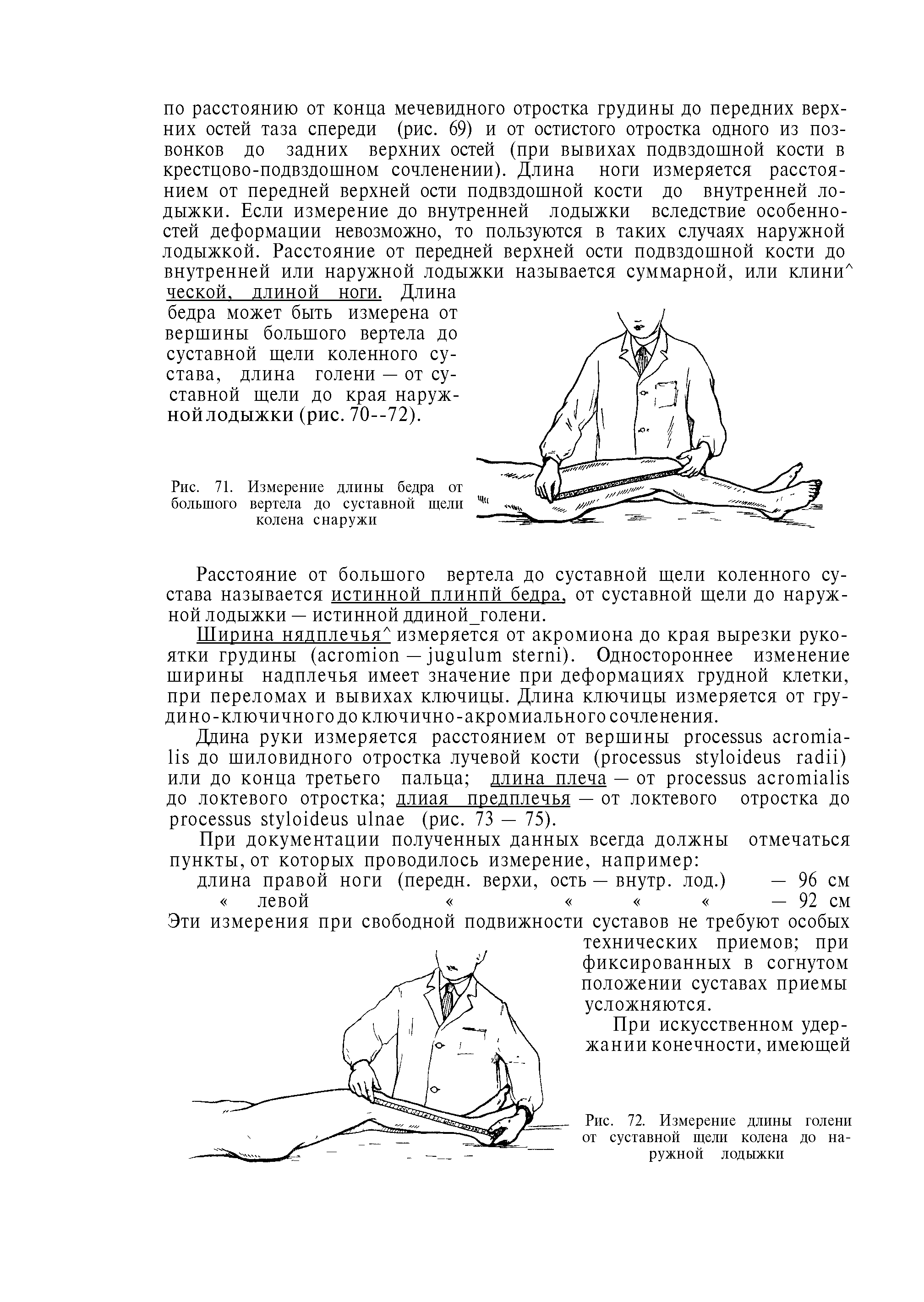 Рис. 72. Измерение длины голени от суставной щели колена до наружной лодыжки...