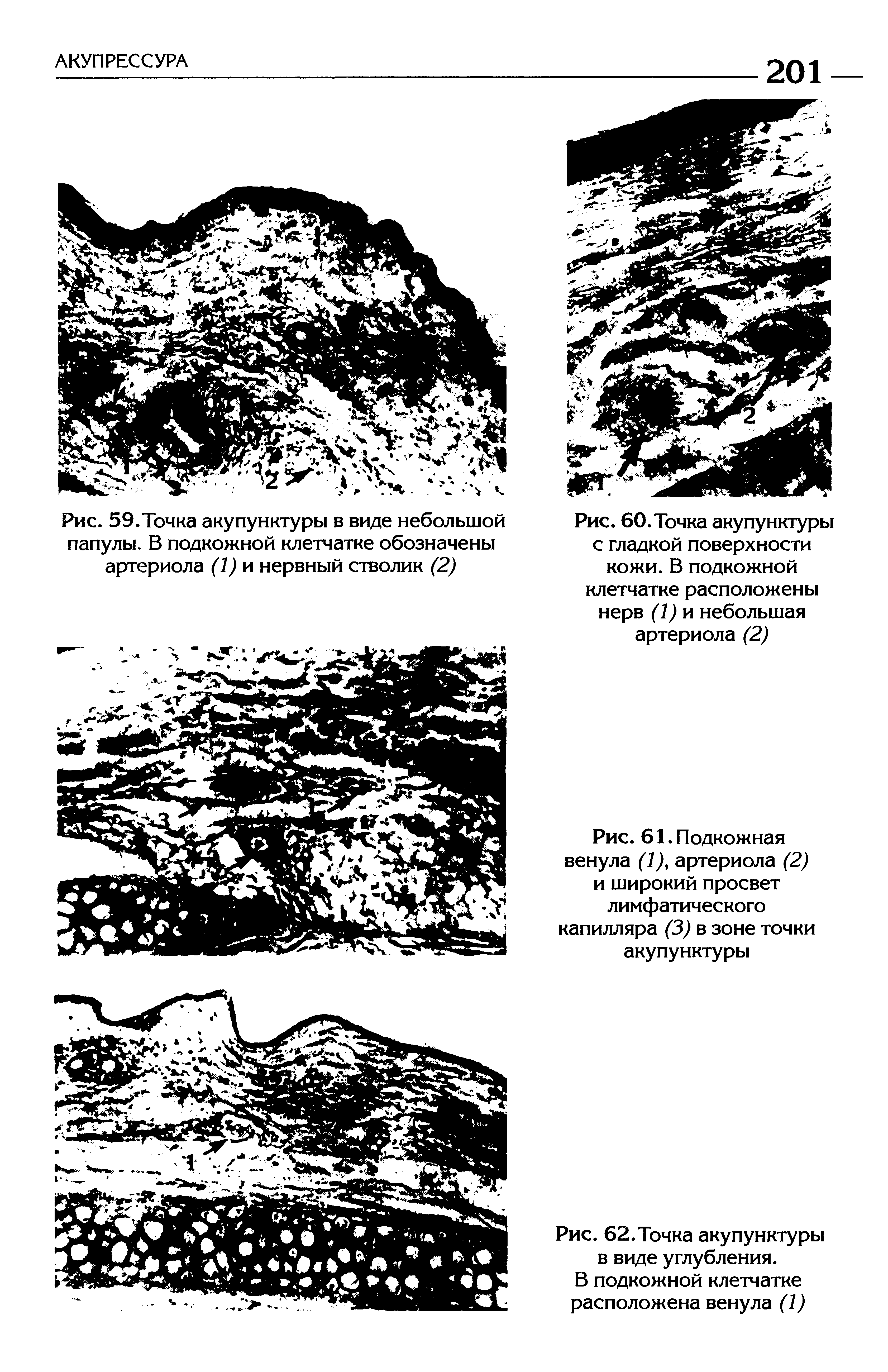 Рис. 61. Подкожная венула (1), артериола (2) и широкий просвет лимфатического капилляра (3) в зоне точки акупунктуры...