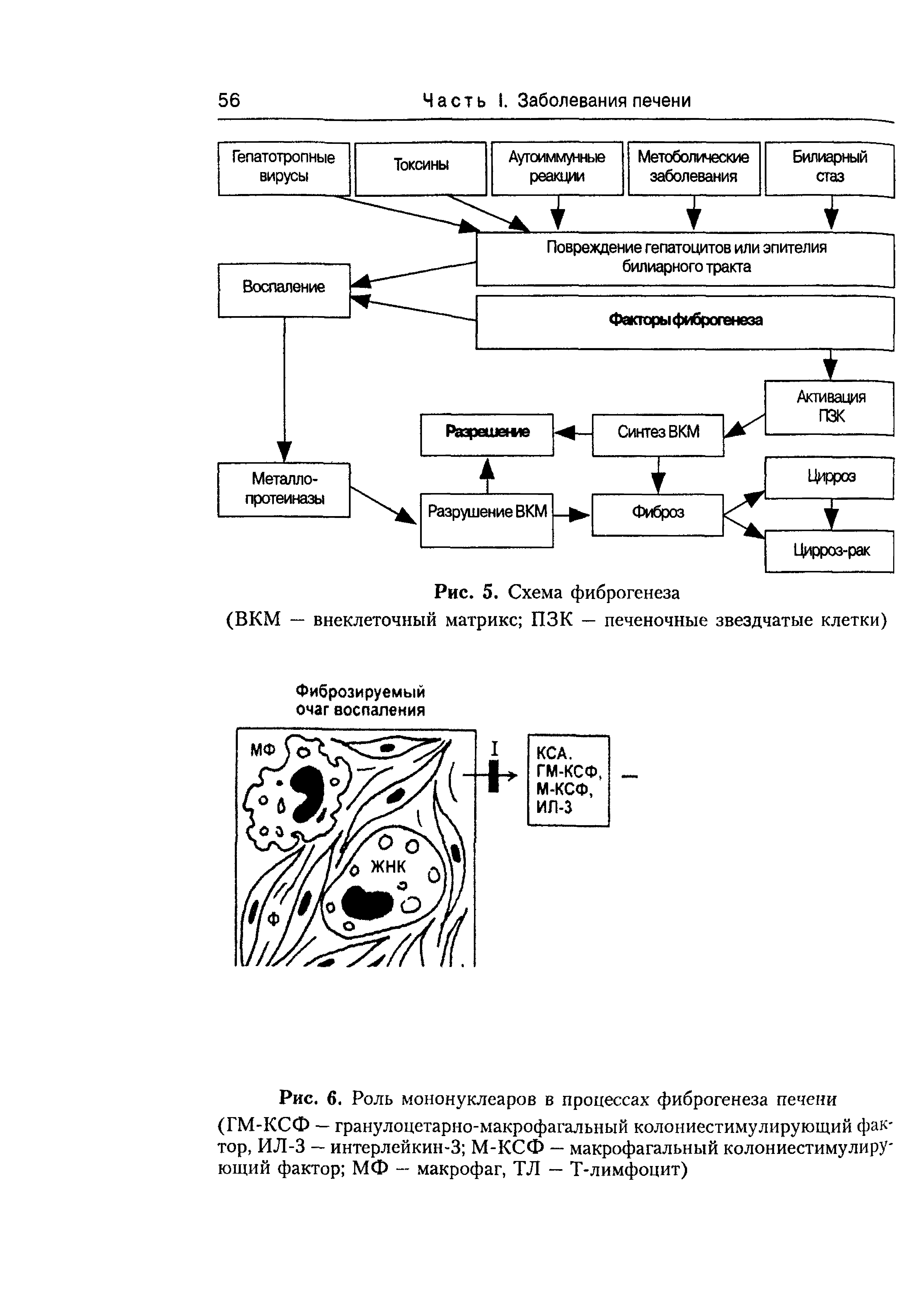 Рис. 6. Роль мононуклеаров в процессах фиброгенеза печени (ГМ-КСФ — гранулоцетарно-макрофагальный колониестимулирующий фактор, ИЛ-3 — интерлейкин-3 М-КСФ — макрофагальный колониестимулирУ ющий фактор МФ — макрофаг, ТЛ — Т-лимфоцит)...