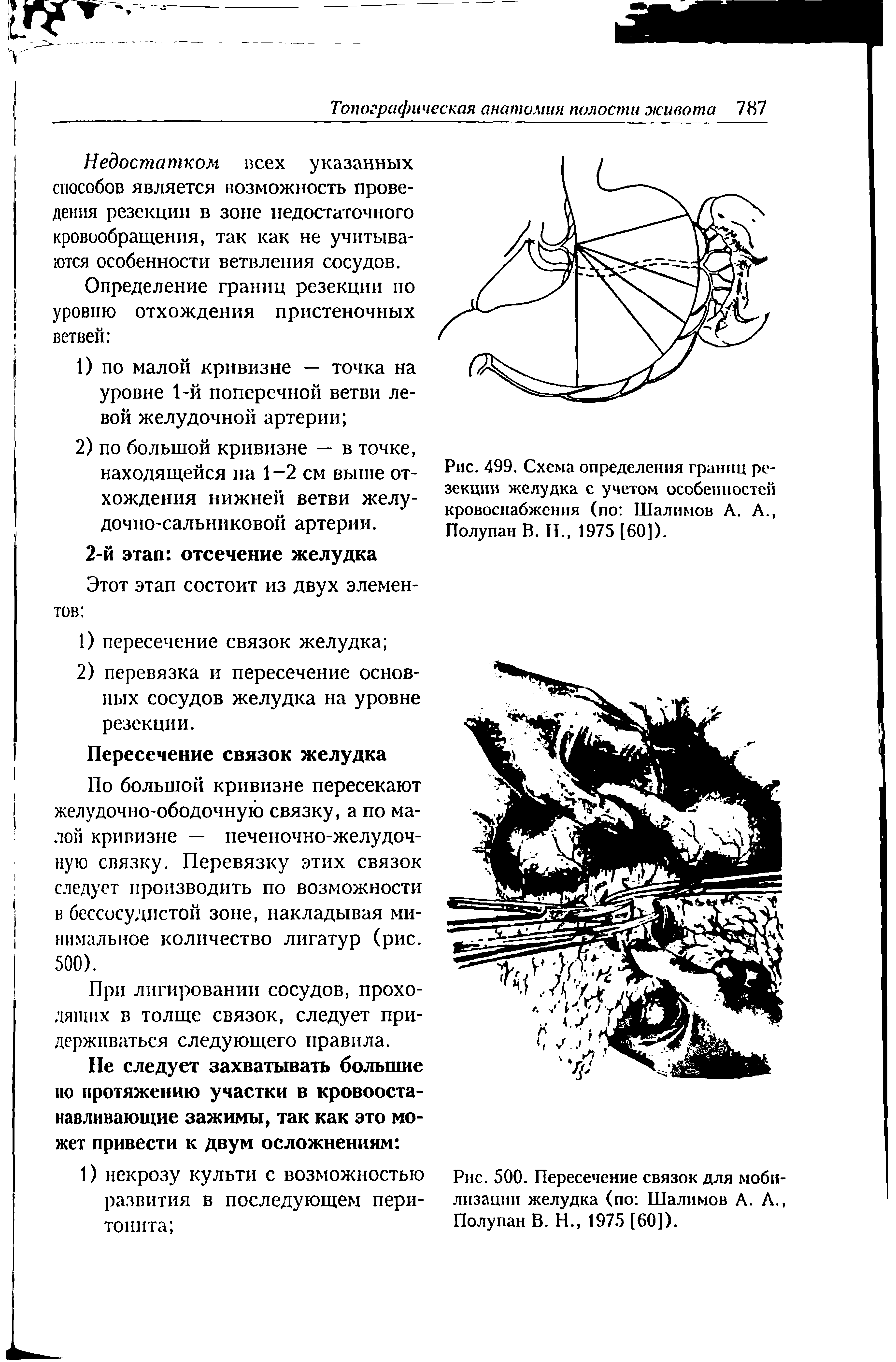 Рис. 499. Схема определения границ резекции желудка с учетом особенностей кровоснабжения (по Шалимов А. А., Полупан В. Н., 1975 [60]).