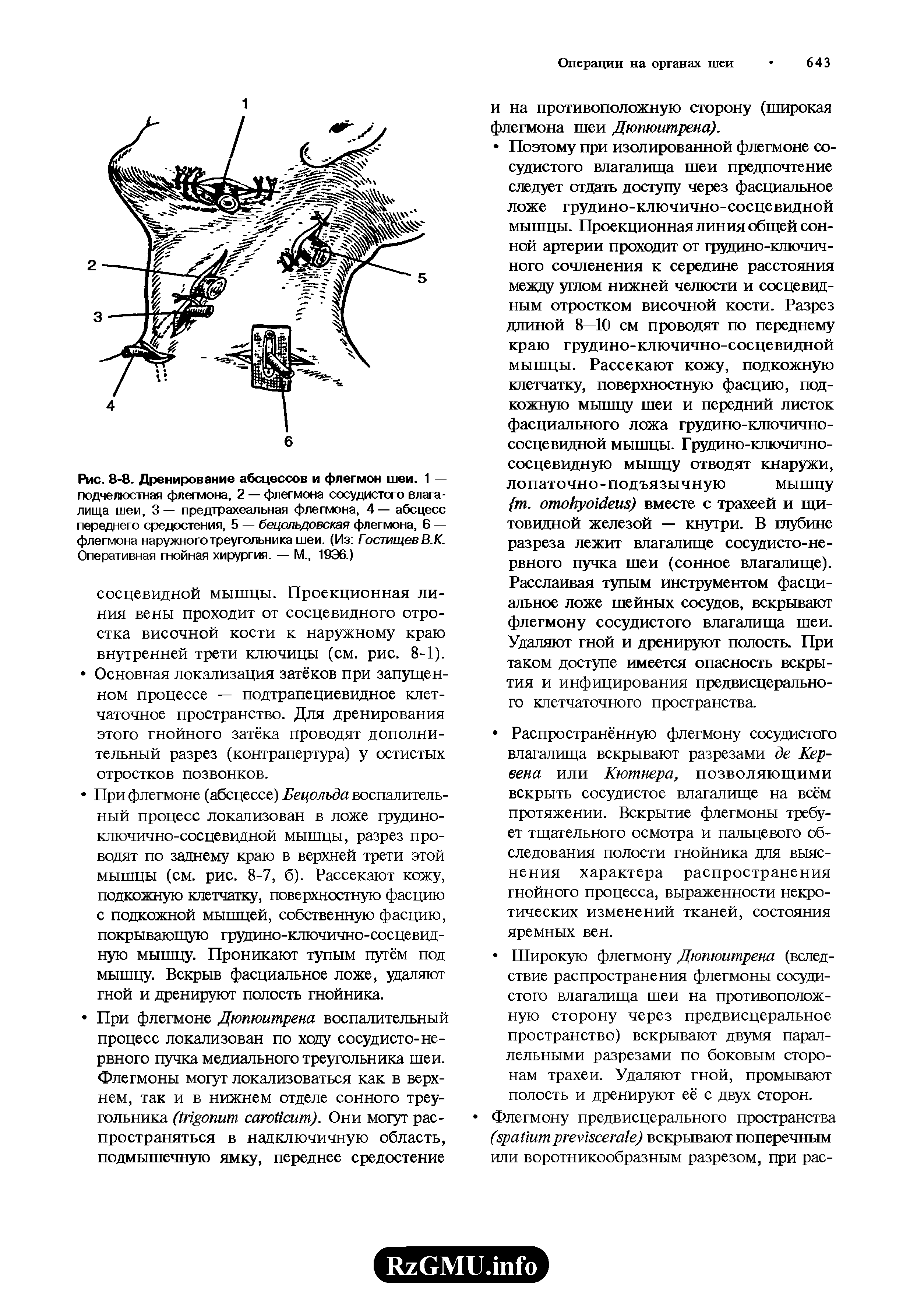 Рис. 8-8. Дренирование абсцессов и флегмон шеи. 1 — подчелюстная флегмона, 2 — флегмона сосудистого влагалища шеи, 3— предтрахеальная флегмона, 4— абсцесс переднего средостения, 5 — бецольдовская флегмона, 6 — флегмона наружного треугольника шеи. (Из ГостищевВ.К. Оперативная гнойная хирургия. — М., 19Э6.)...