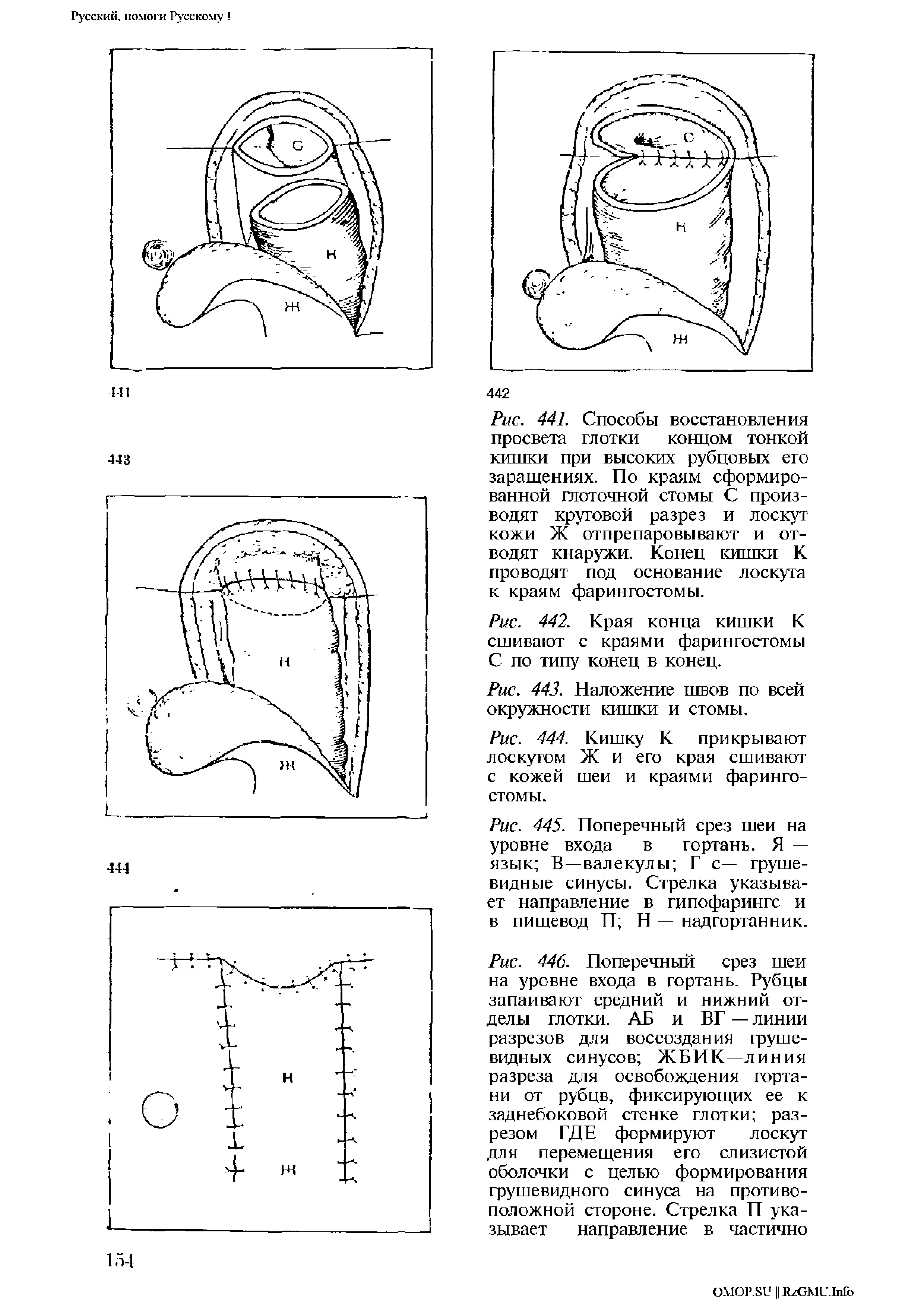 Рис. 442. Края конца кишки К сшивают с краями фарингостомы С по типу конец в конец.