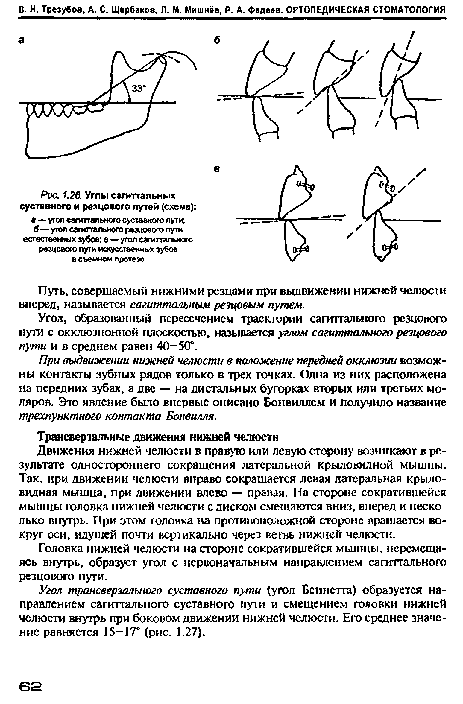 Рис. 1.26. Углы сагиттальных суставного и резцового путей (схема) а — угол сагиттального суставного пути б — угол сагиттального резцового пути естественгых зубое в — угол сагиттального резцового пути искусственных зубов в съемном протезе...