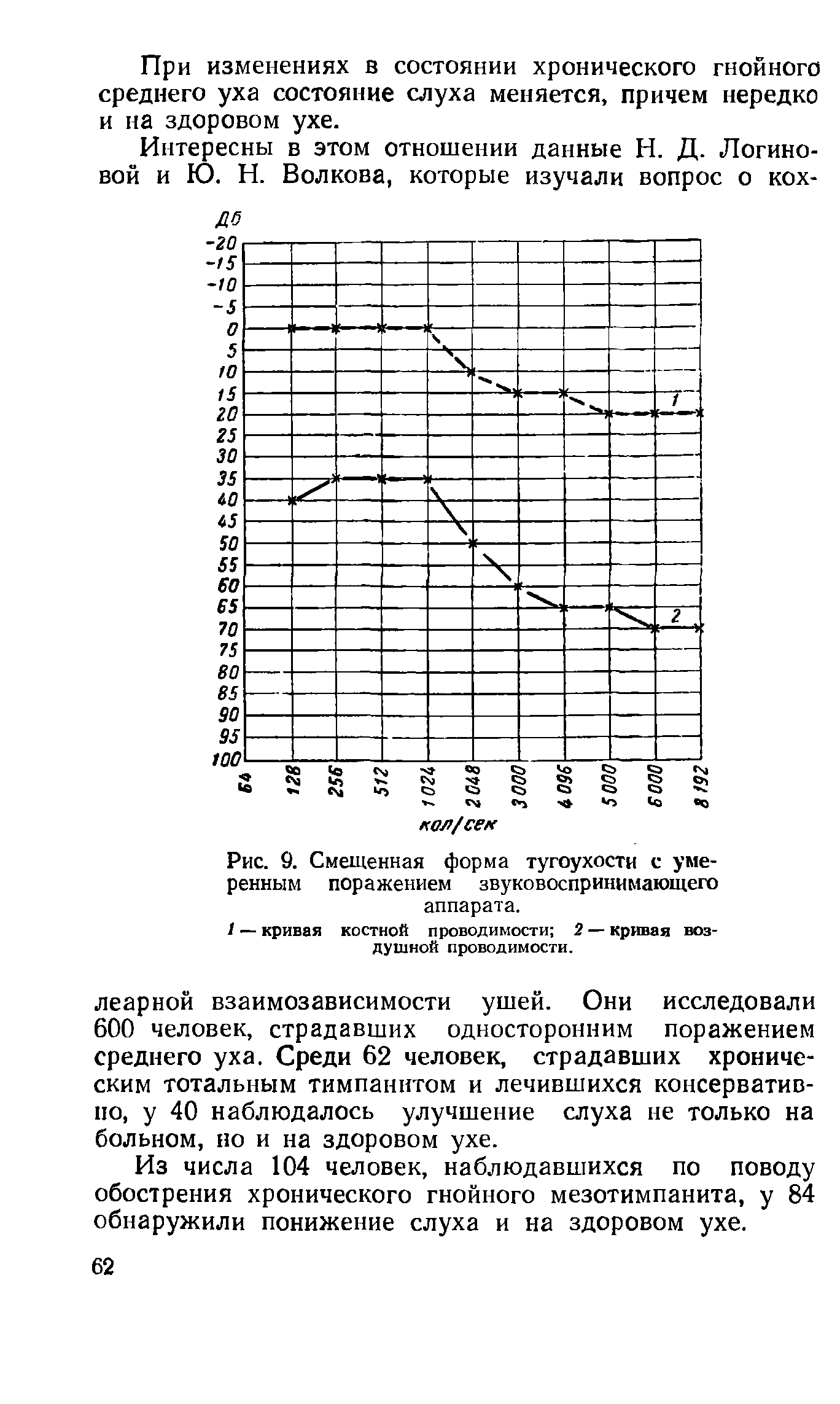 Рис. 9. Смещенная форма тугоухости с умеренным поражением звуковоспринимающего аппарата.