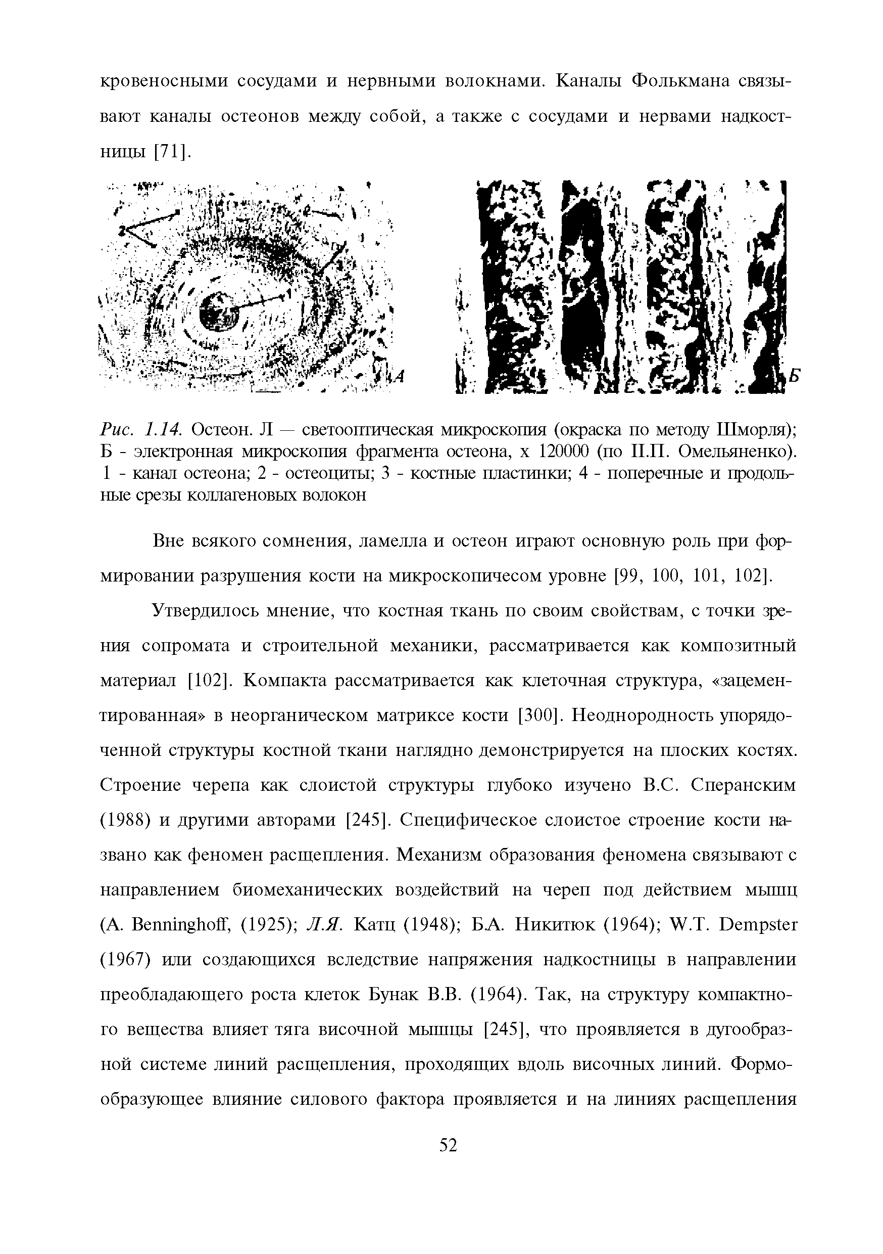 Рис. 1.14. Остеон. Л — светооптическая микроскопия (окраска по методу Шморля) Б - электронная микроскопия фрагмента остеона, х 120000 (по П.П. Омельяненко). 1 - канал остеона 2 - остеоциты 3 - костные пластинки 4 - поперечные и продольные срезы коллагеновых волокон...