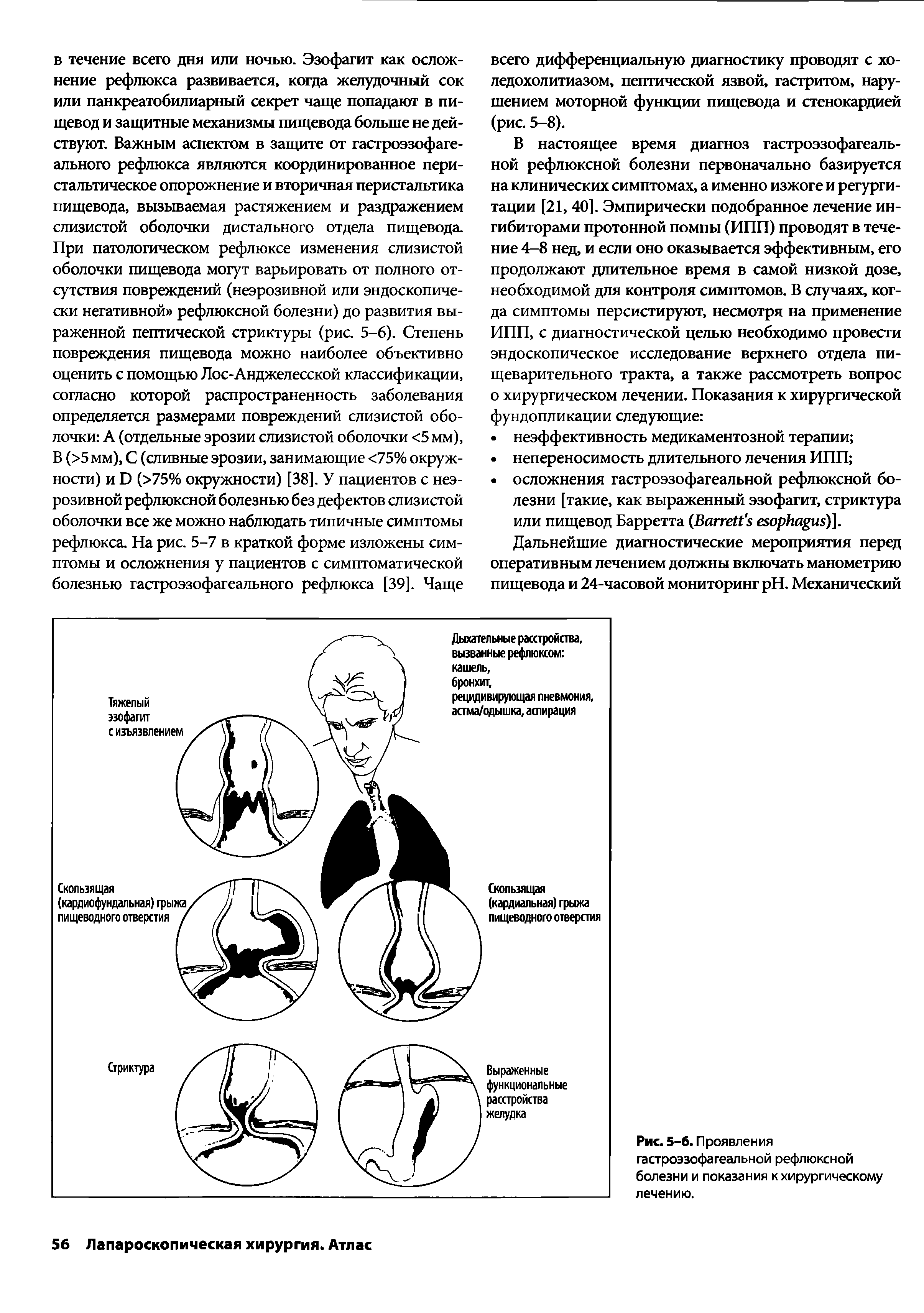 Рис. 5-6. Проявления гастроэзофагеальной рефлюксной болезни и показания к хирургическому лечению.
