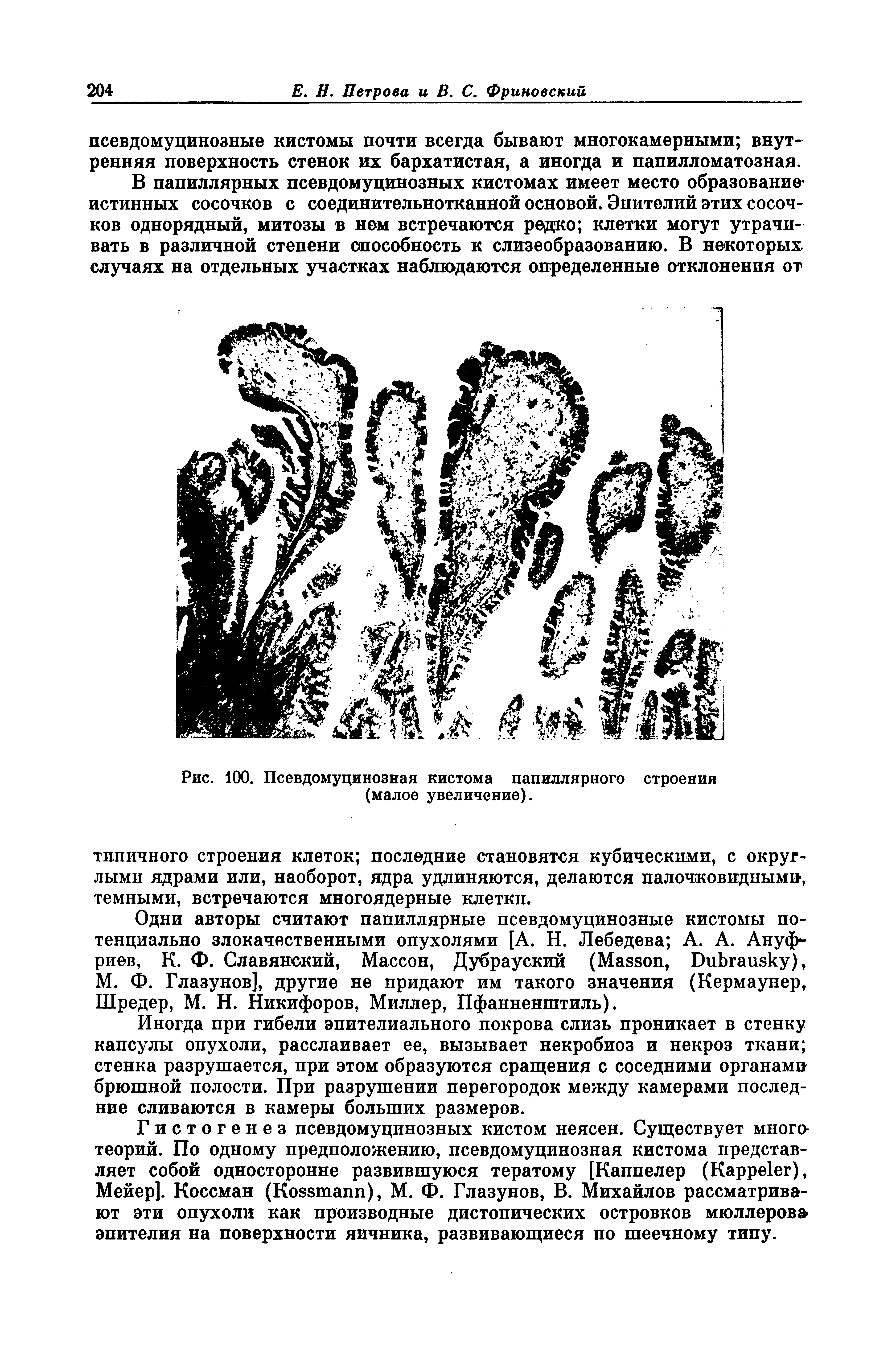 Рис. 100. Псевдомуцинозная кистома папиллярного строения (малое увеличение).