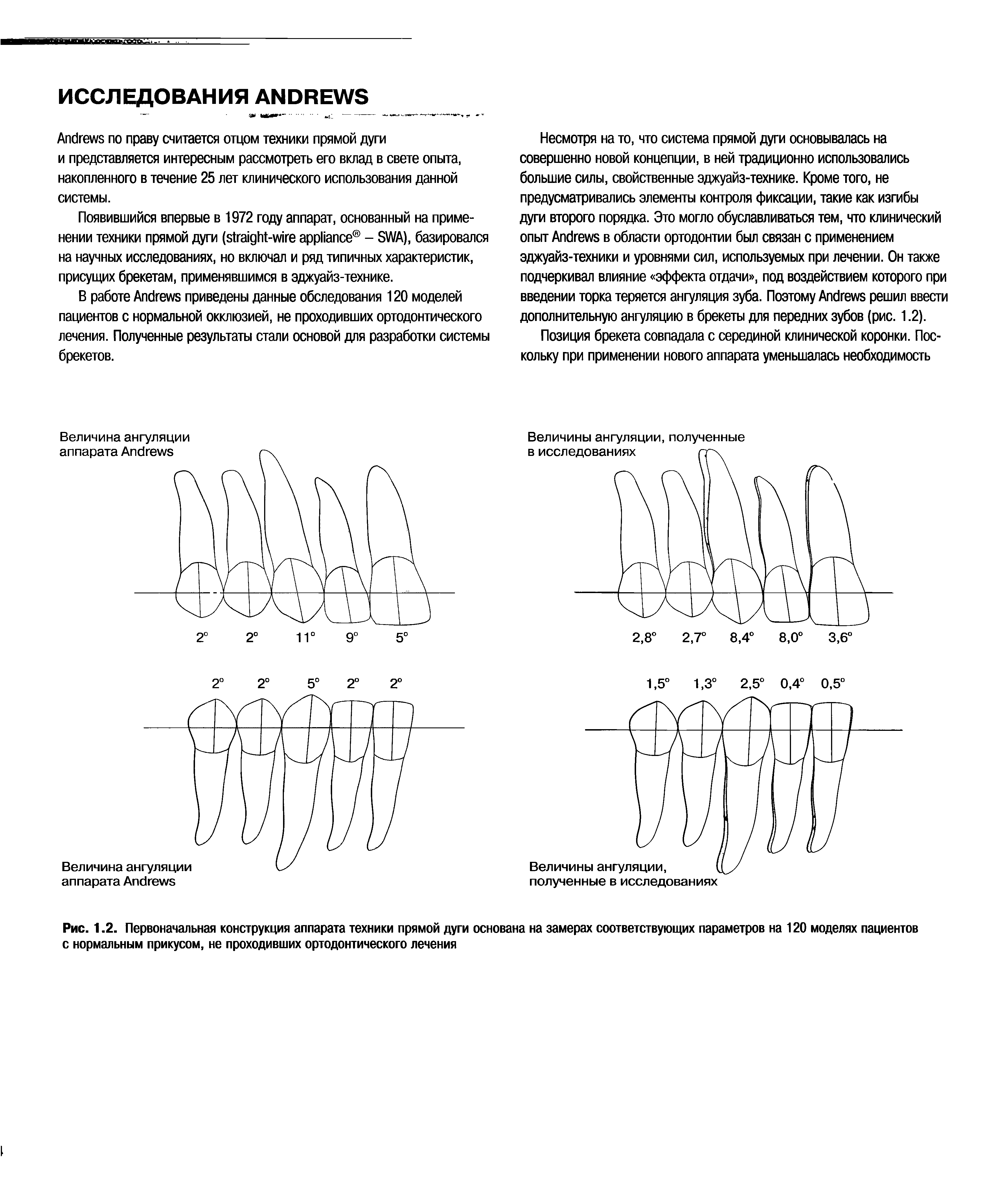 Рис. 1.2. Первоначальная конструкция аппарата техники прямой дуги основана на замерах соответствующих параметров на 120 моделях пациентов с нормальным прикусом, не проходивших ортодонтического лечения...