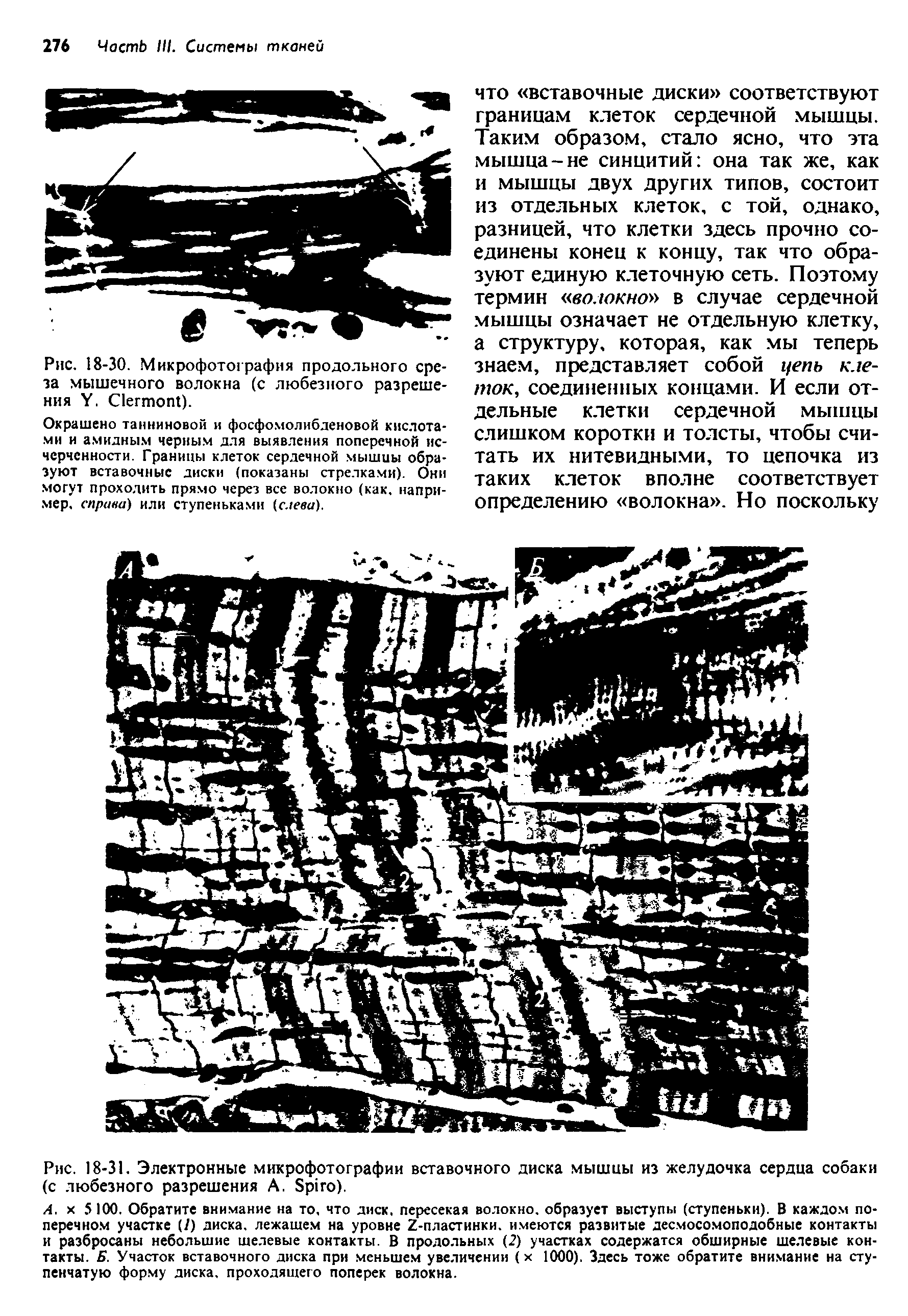 Рис. 18-31. Электронные микрофотографии вставочного диска мышцы из желудочка сердца собаки (с любезного разрешения A. S ).