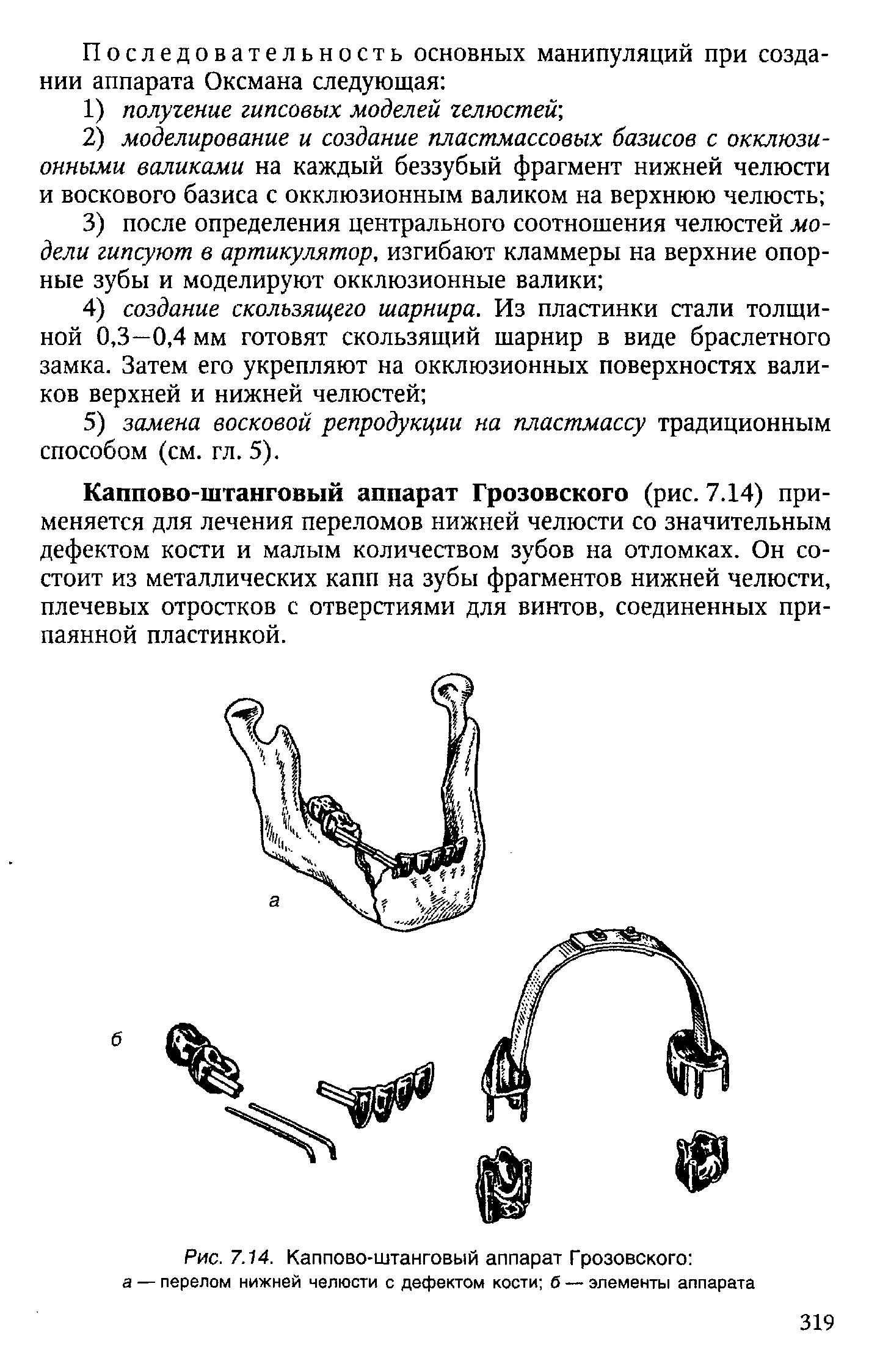 Рис. 7.14. Каппово-штанговый аппарат Грозовского а — перелом нижней челюсти с дефектом кости б — элементы аппарата...