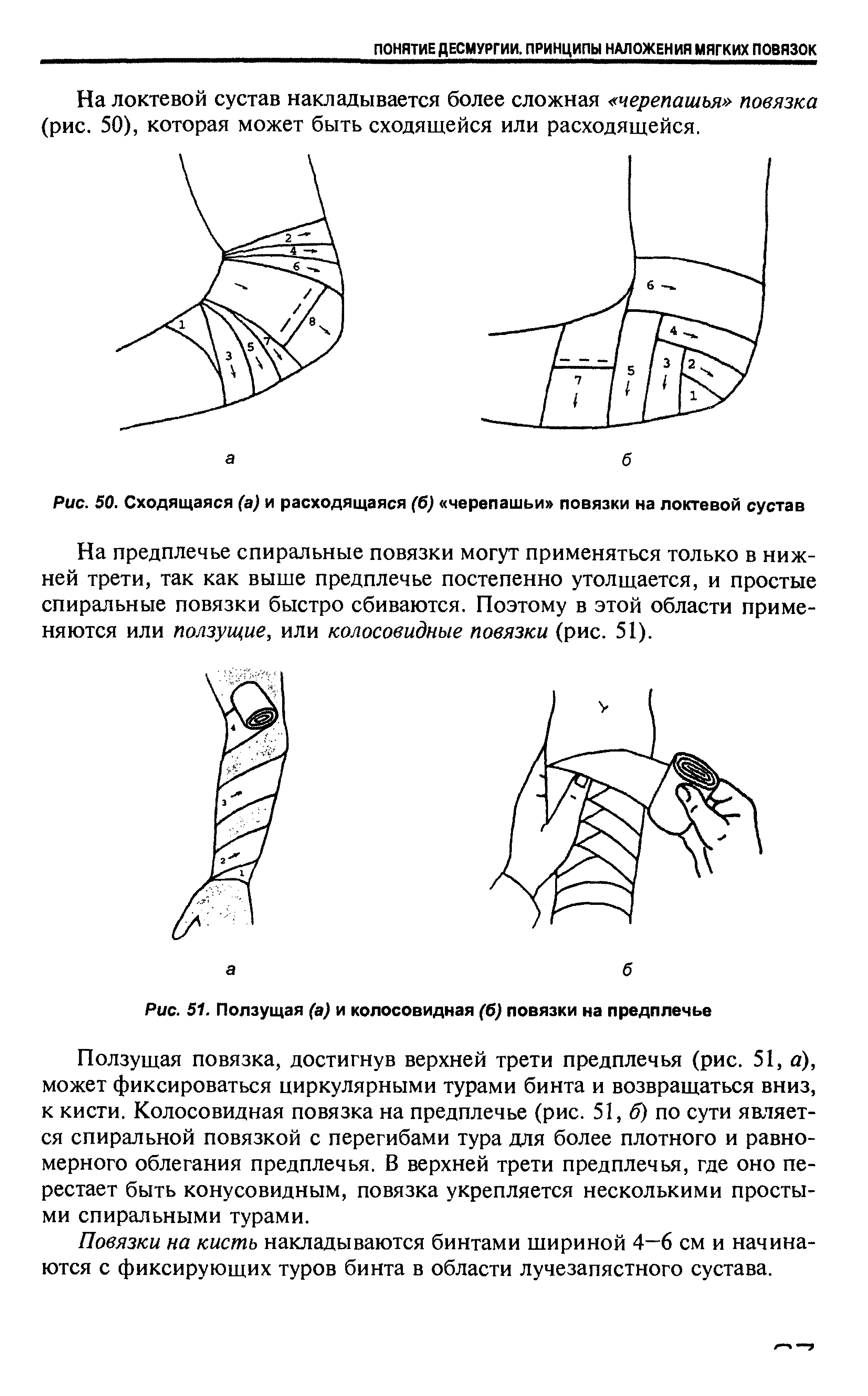 Рис. 50. Сходящаяся (а) и расходящаяся (б) черепашьи повязки на локтевой сустав...