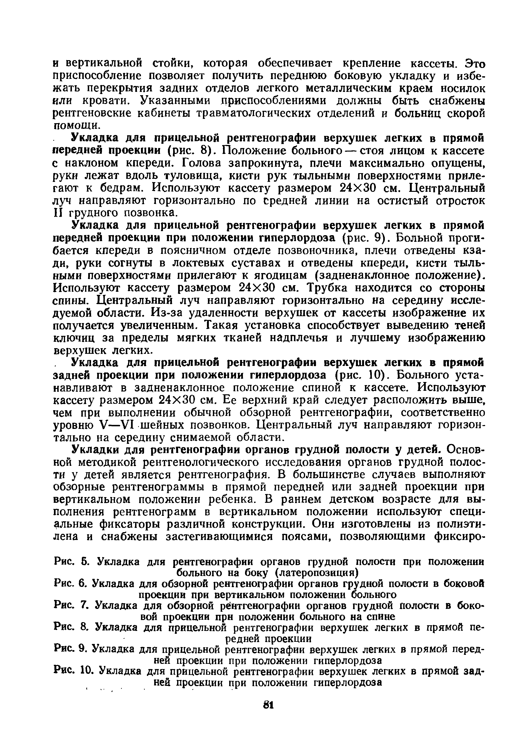 Рис. 8. Укладка для прицельной рентгенографии верхушек легких в прямой передней проекции...