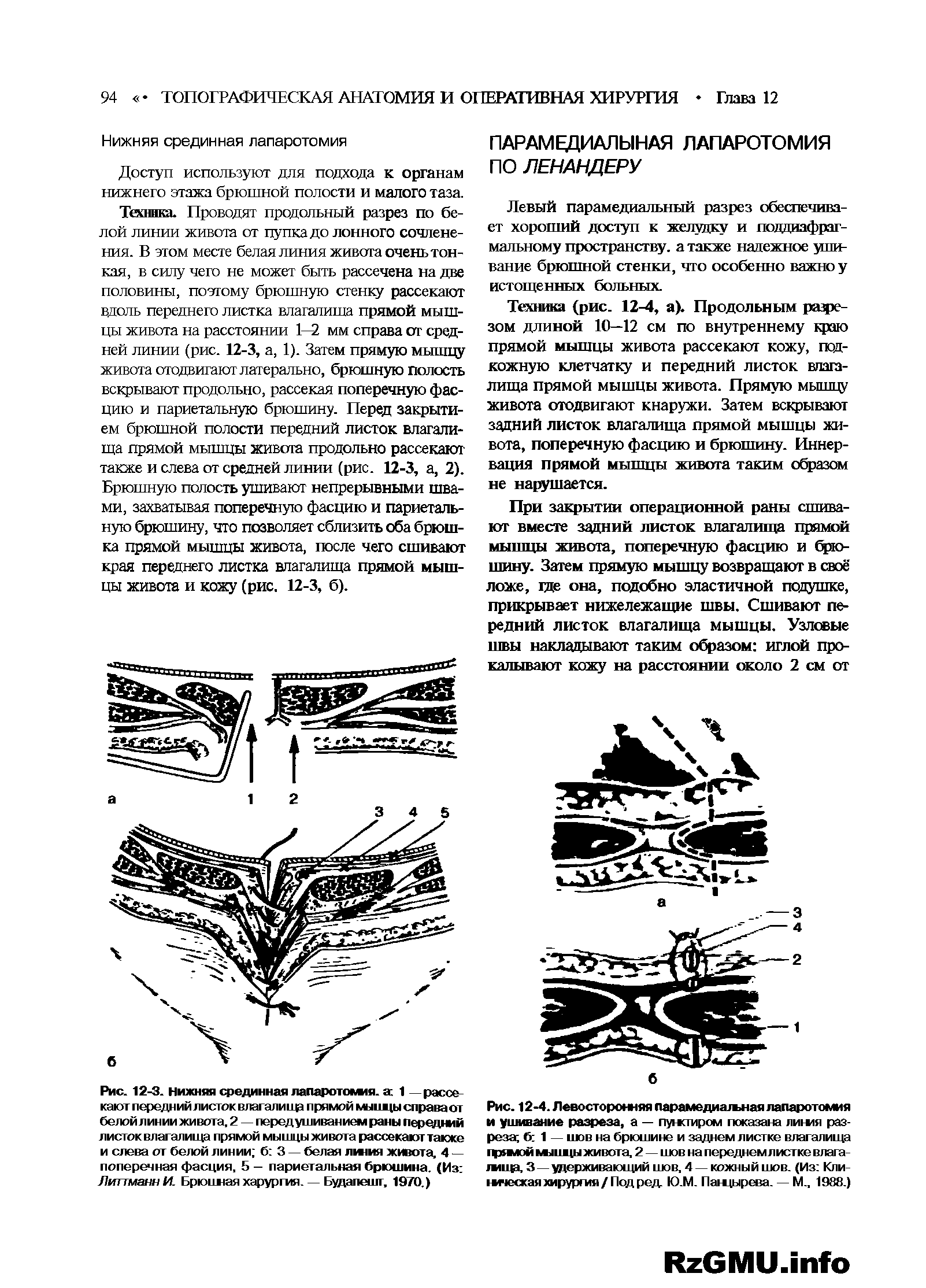 Рис. 12-4. Левосторонняя парамедиатьная лапаротомия и ушивание разреза, а — пумсгиром показана линия разреза б 1 — шов на брюшине и заднем листке влагалища гдоыой мледы живота, 2 — шов на переднем листке влага-танда, 3—удерживающий шов, 4 — кожный шов. (Из Кли мнеская хирургия/Под ред. Ю.М. Пащырева. — М., 1988.)...
