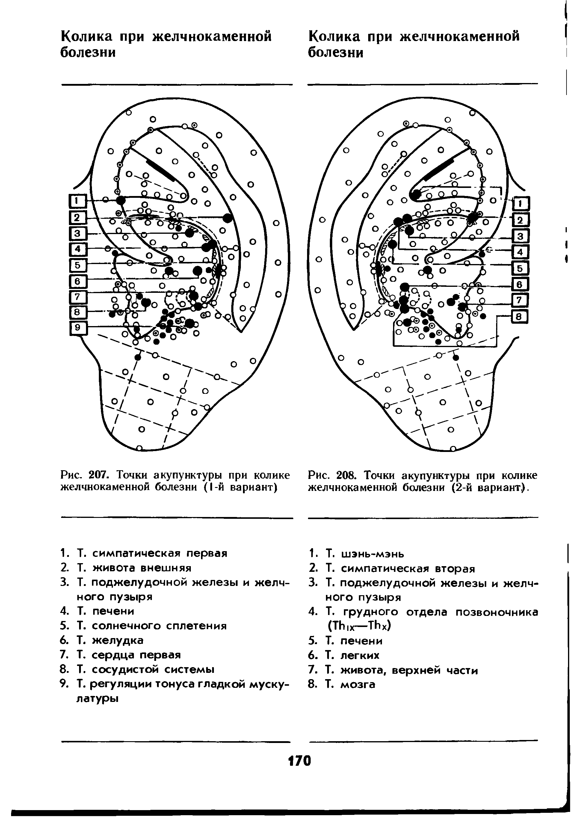 Рис. 207. Точки акупунктуры при колике желчнокаменной болезни (1-й вариант)...