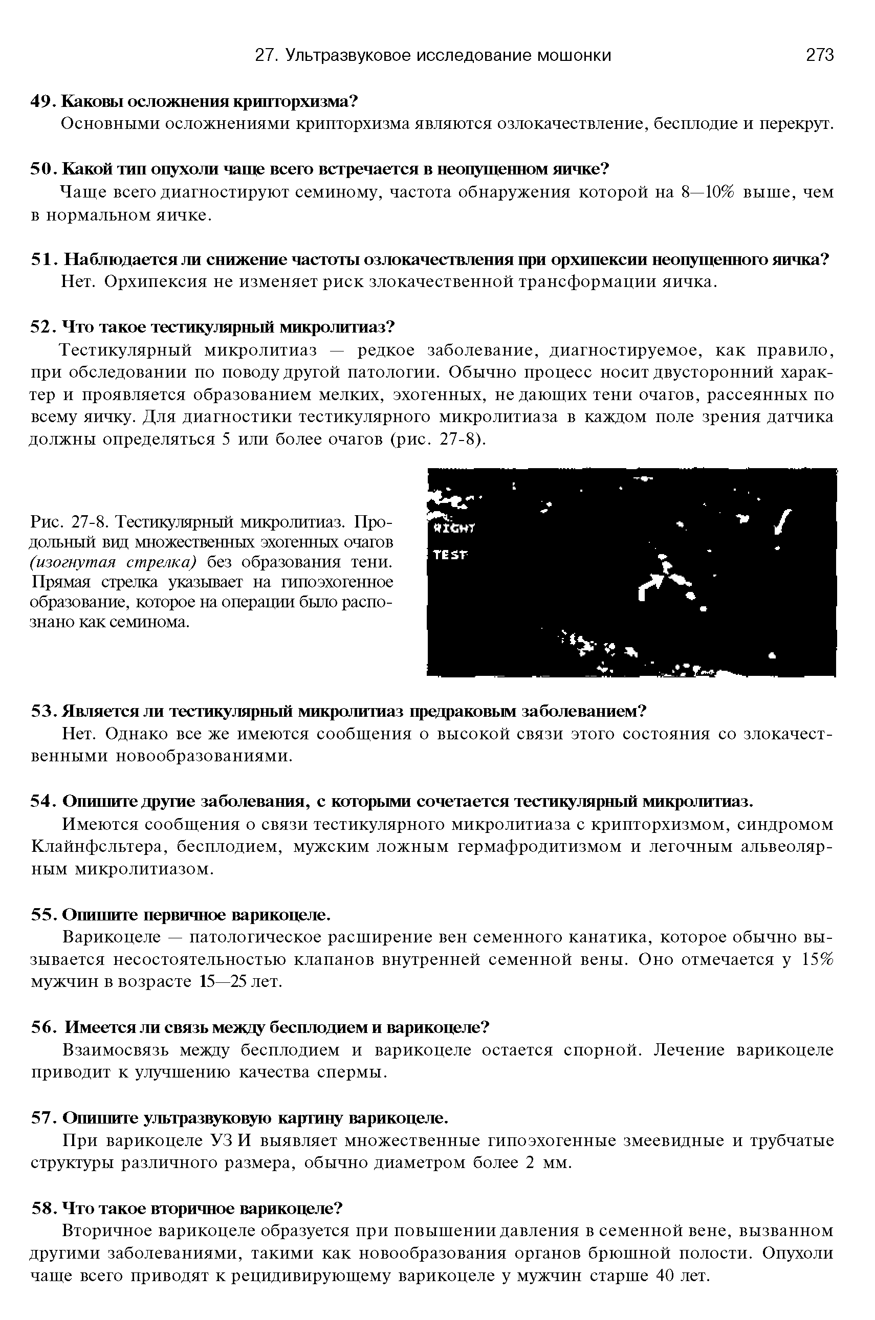 Рис. 27-8. Тестикулярный микролитиаз. Продольный вид множественных эхогенных очагов (изогнутая стрелка) без образования тени. Прямая стрелка указывает на гипоэхогенное образование, которое на операции было распознано как семинома.