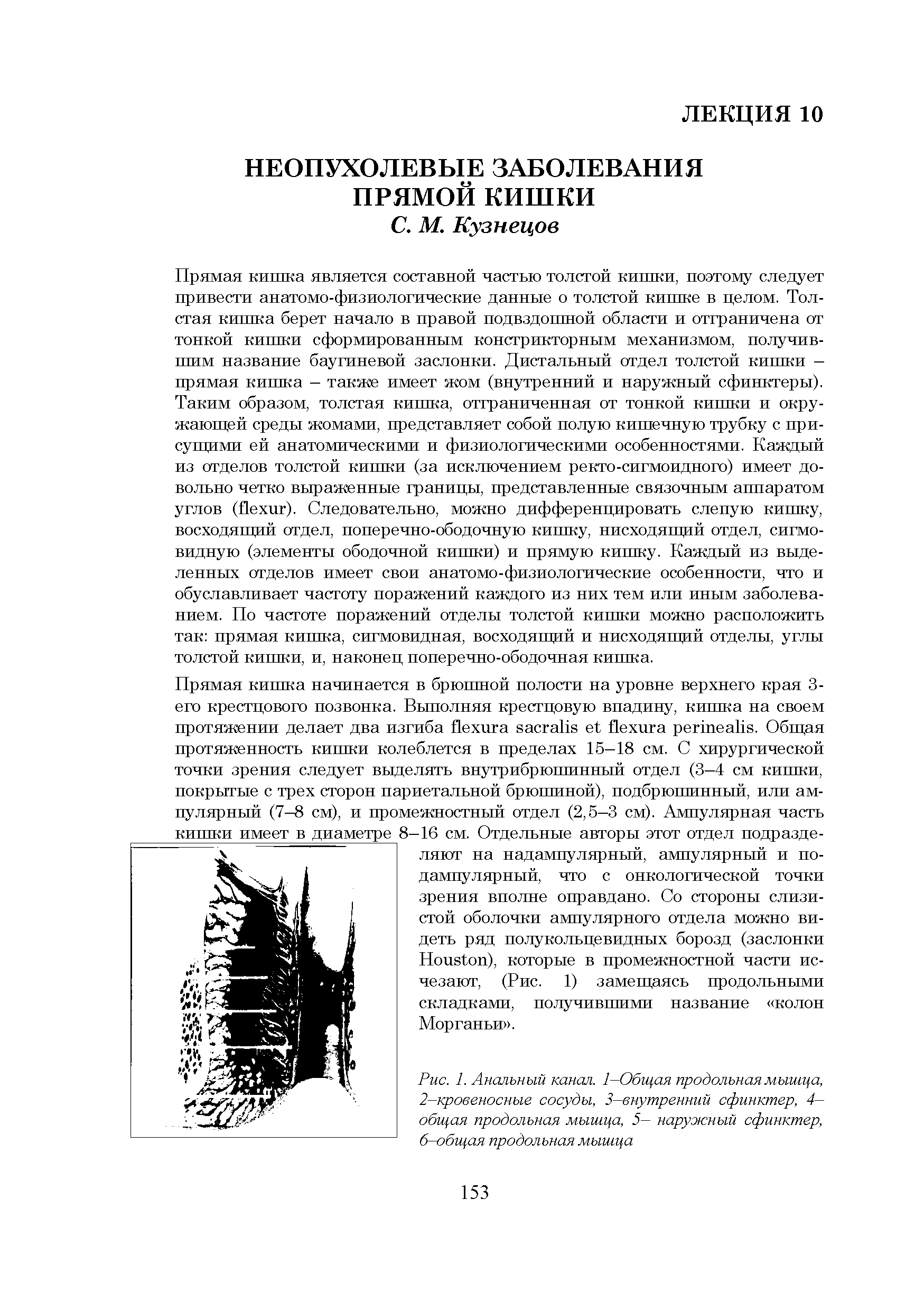 Рис. 1. Анальный канал. 1—Общая продольная мышца, 2—кровеносные сосуды, 3—внутренний сфинктер, 4— общая продольная мышца, 5— наружный сфинктер, 6-общая продольная мышца...