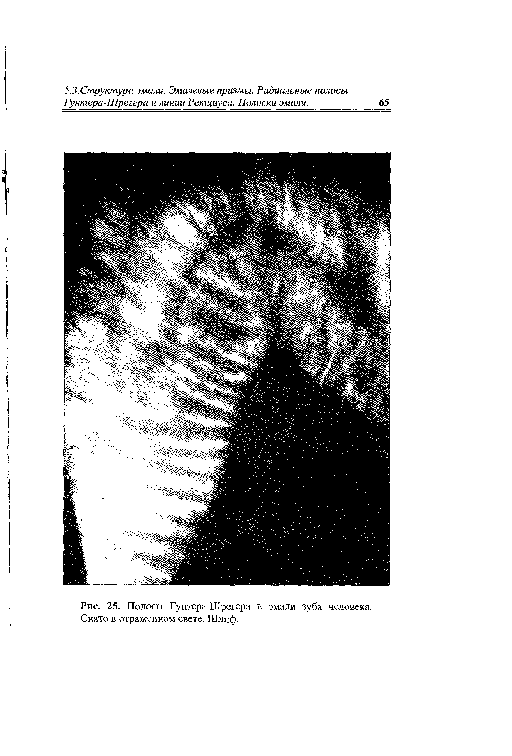 Рис. 25. Полосы Гунтера-Шрегера в эмали зуба человека. Снято в отраженном свете. Шлиф.