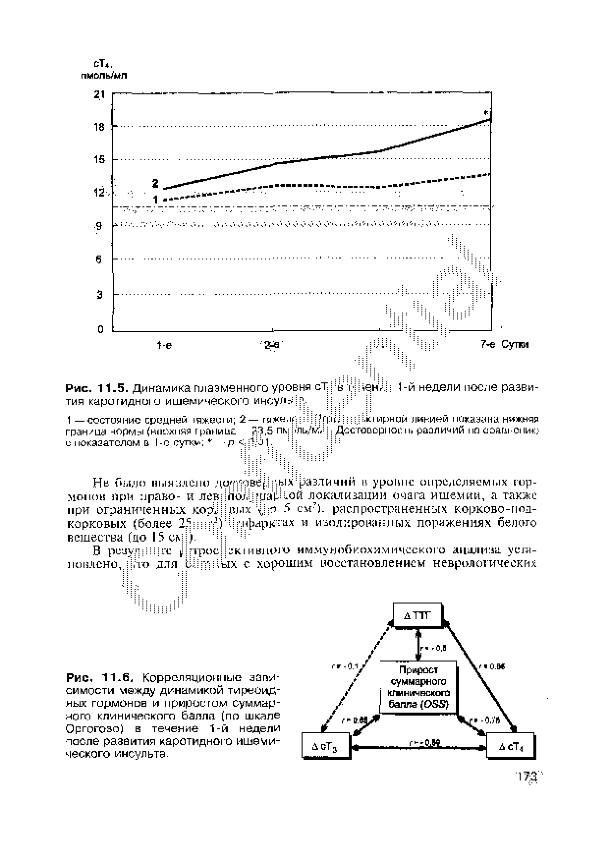 Рис. 11-6, Корреляционные запи-симости между динамикой тиреоидных гормонов и прирос том суммарного клинического балла (по шкале Оргогозо) в течение 1-й недели лаоле развития каротидного ишемического инсульта.