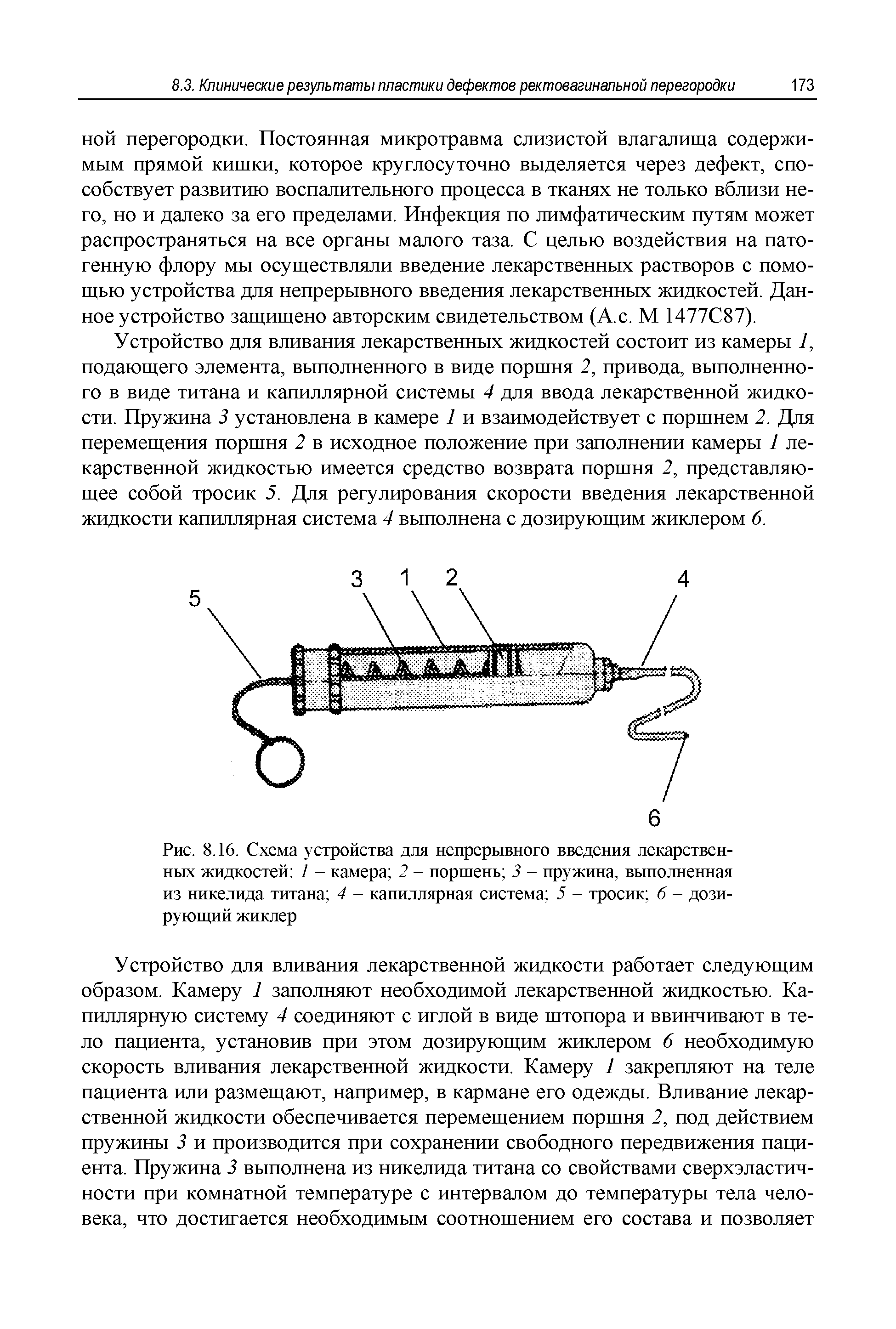 Рис. 8.16. Схема устройства для непрерывного введения лекарственных жидкостей 1 - камера 2 - поршень 3 - пружина, выполненная из никелида титана 4 - капиллярная система 5 - тросик б - дозирующий жиклер...
