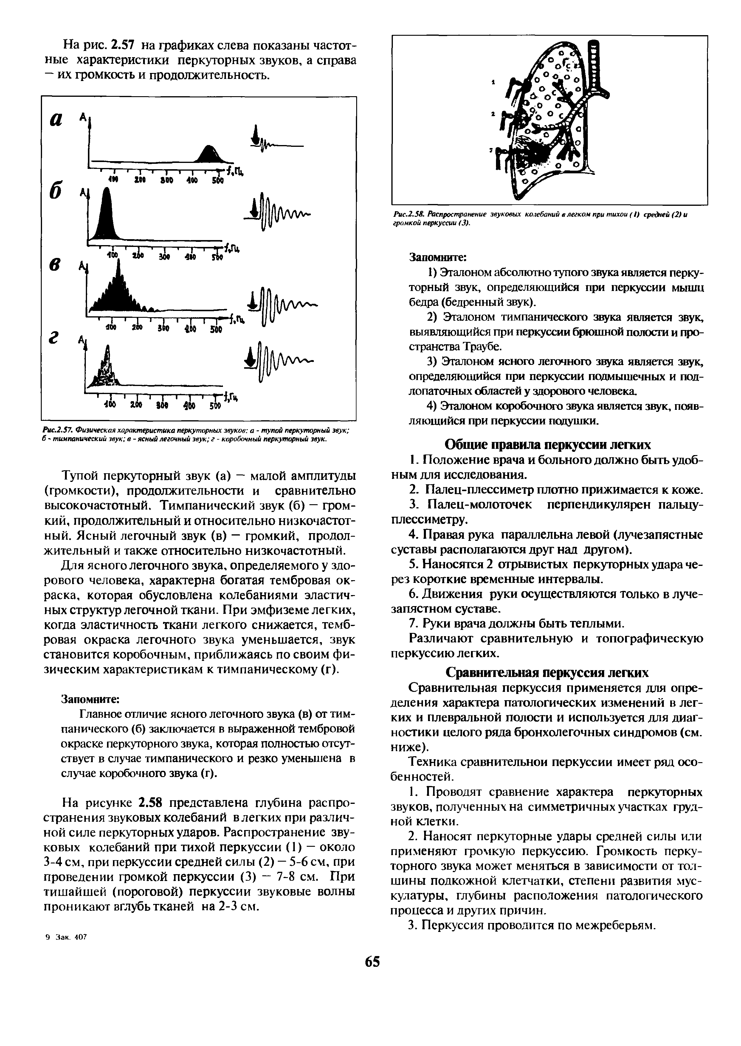 Рис.2.57. Физическая характеристика перкуторных звуков а - тупой перкуторный звук б - тимпанический звук в - ясный легочный звук г - коробочный перкуторный звук.